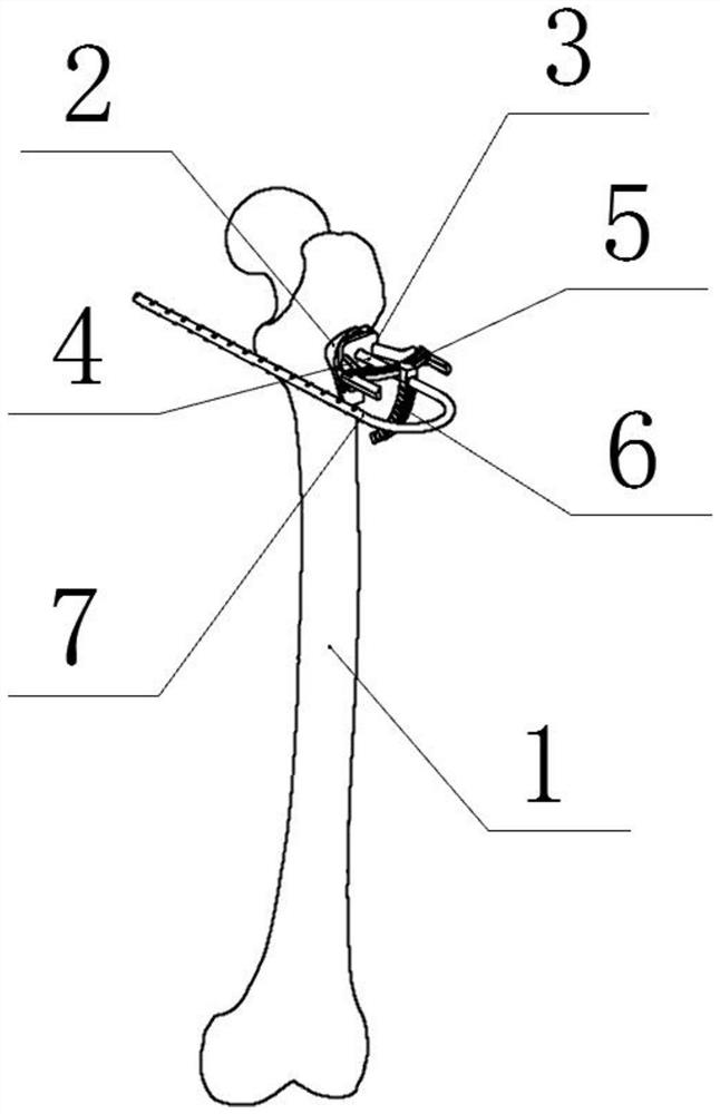 Proximal femur kirschner wire drilling positioning and multi-wire drilling auxiliary device