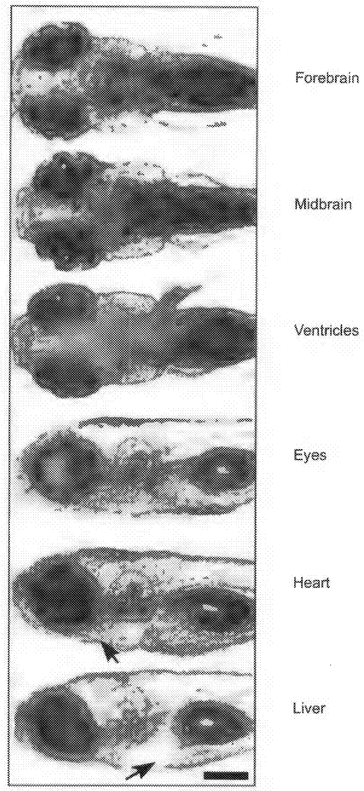 High-Throughput Organ-Targeted Microinjection System