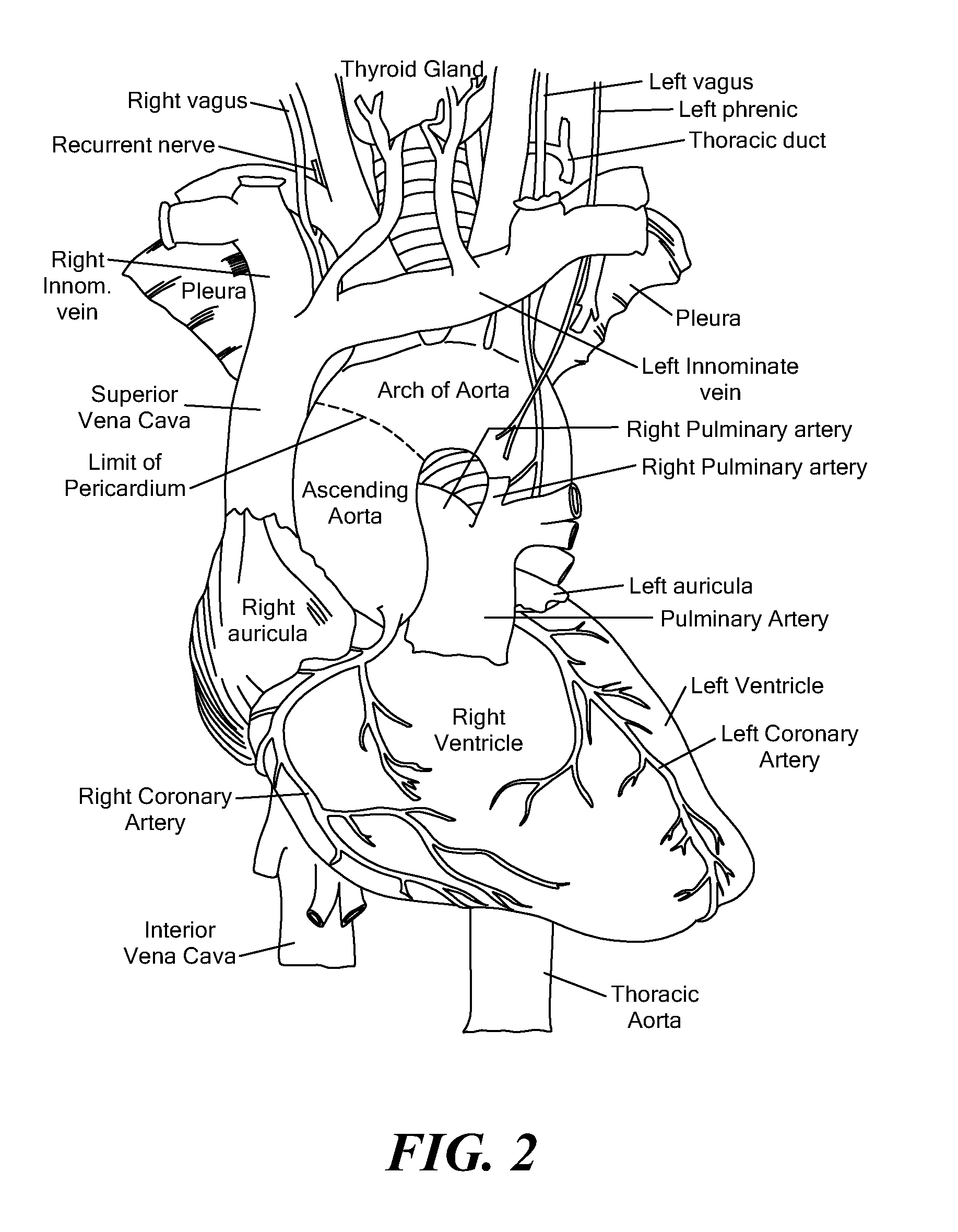 Method and system for preventing nerve injury during a medical procedure