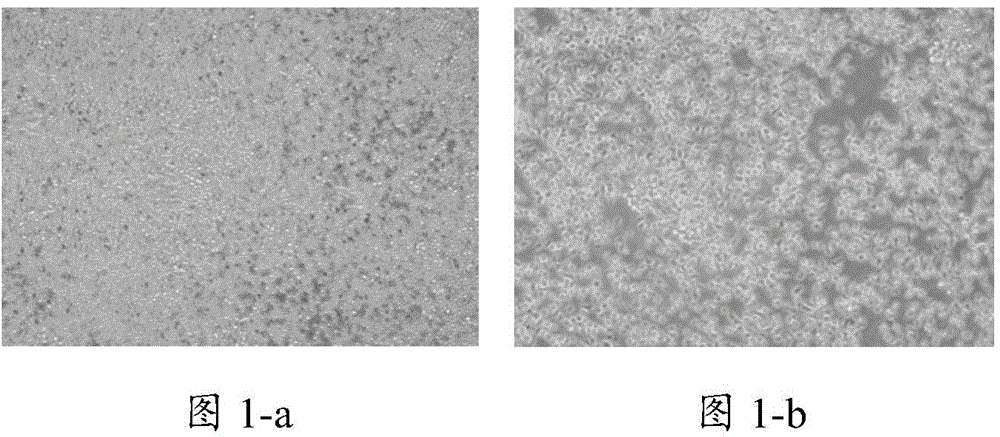 Natural killer cell culture medium and natural killer cell amplification culture method