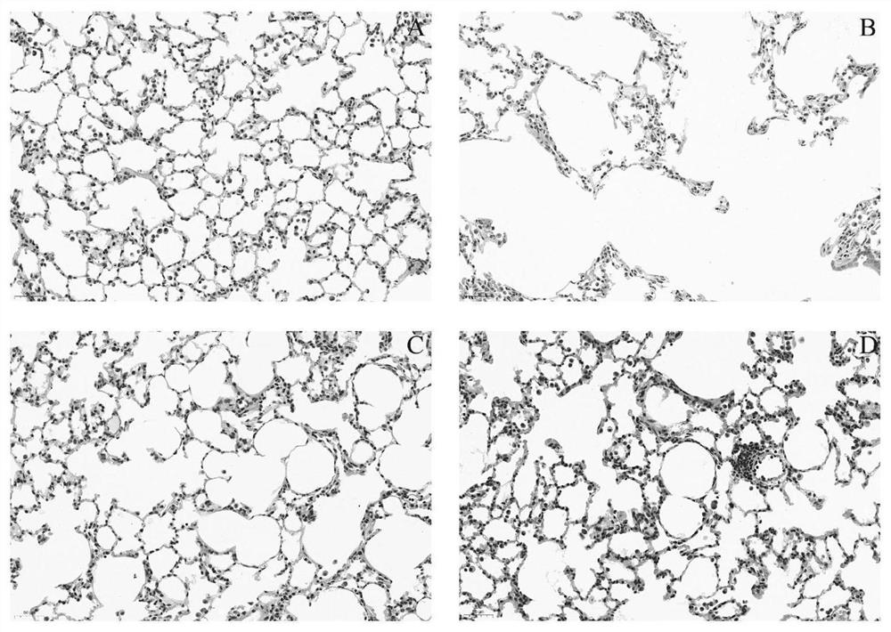 Stable-phase series traditional Chinese medicine prescription for treating chronic obstructive pulmonary disease and application