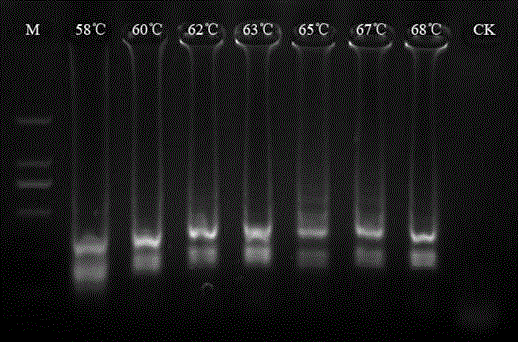 Loop isothermal amplification primer for quickly detecting tylenchulus semipenetrans and application of loop isothermal amplification primer