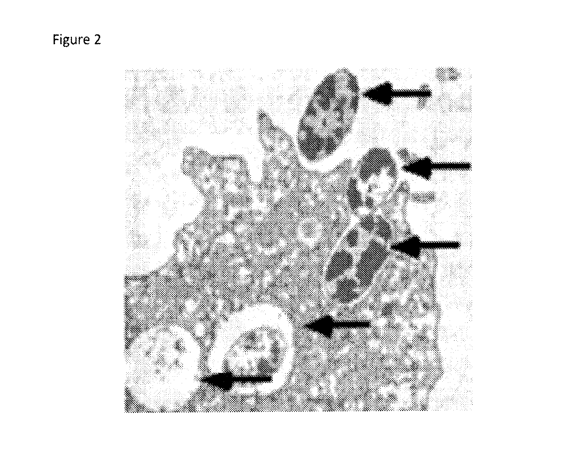 Therapeutic amoeba and uses thereof