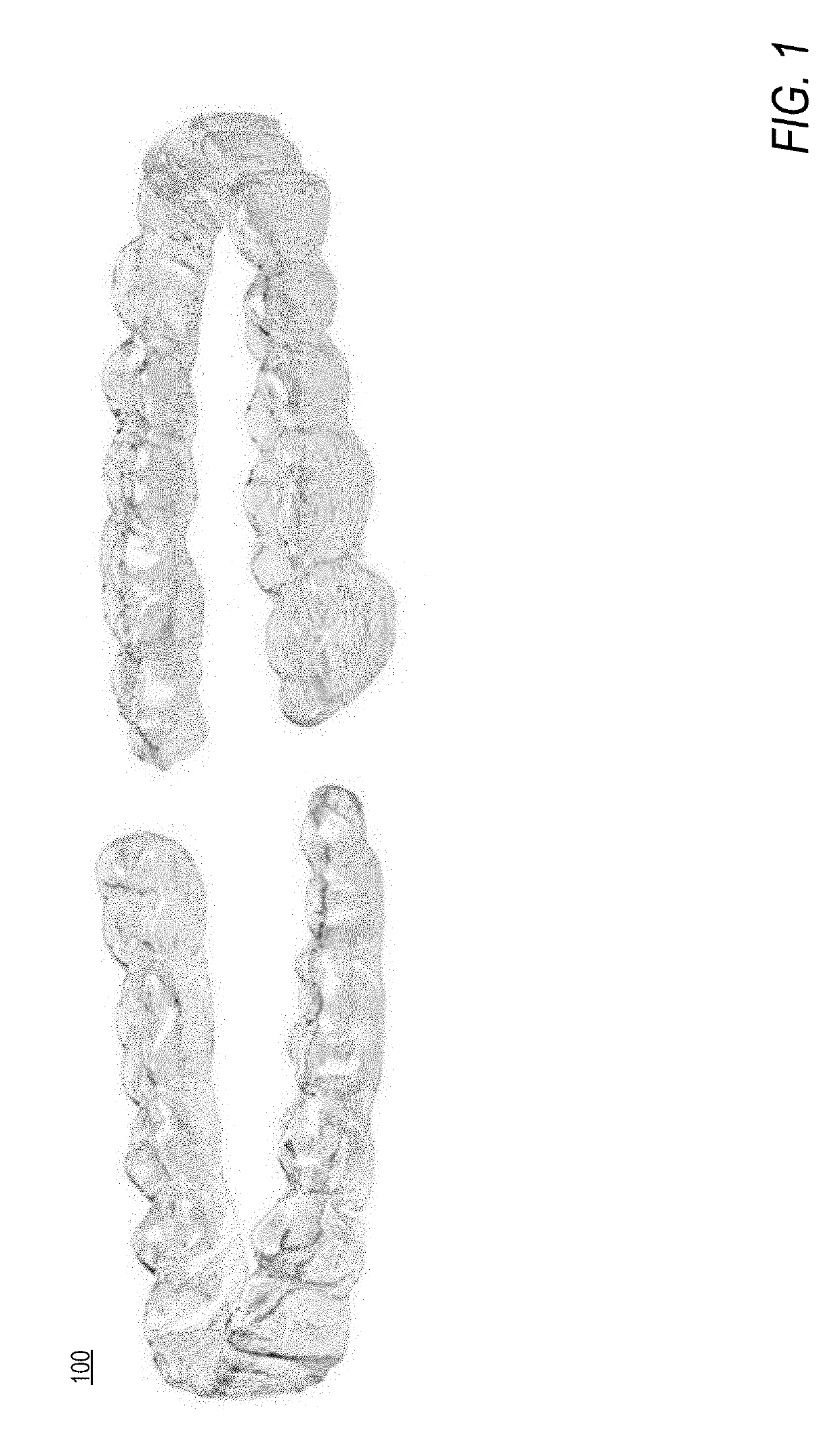 Method and system of teeth alignment based on simulating of crown and root movement