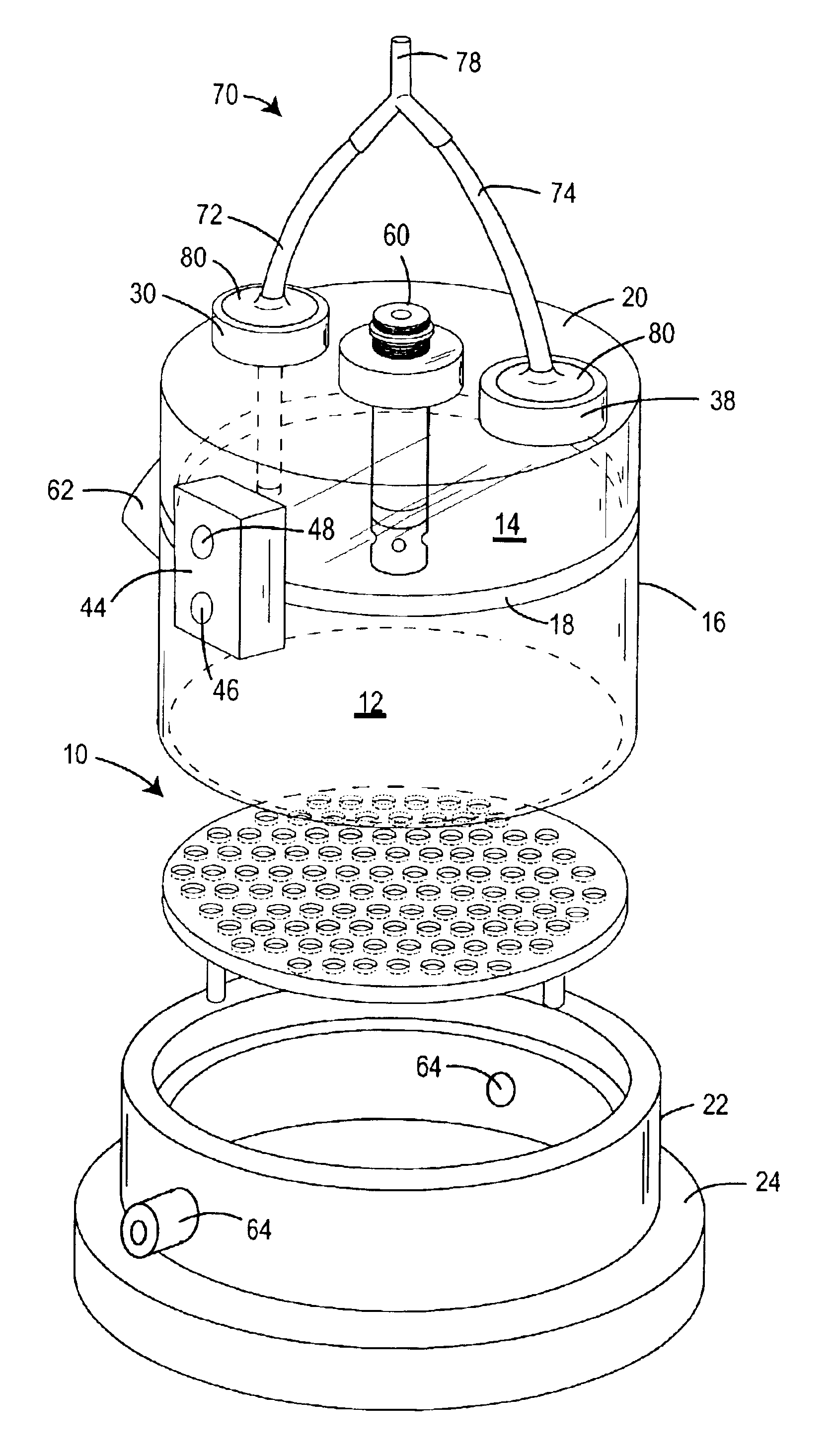 Reduced-noise plethysmograph