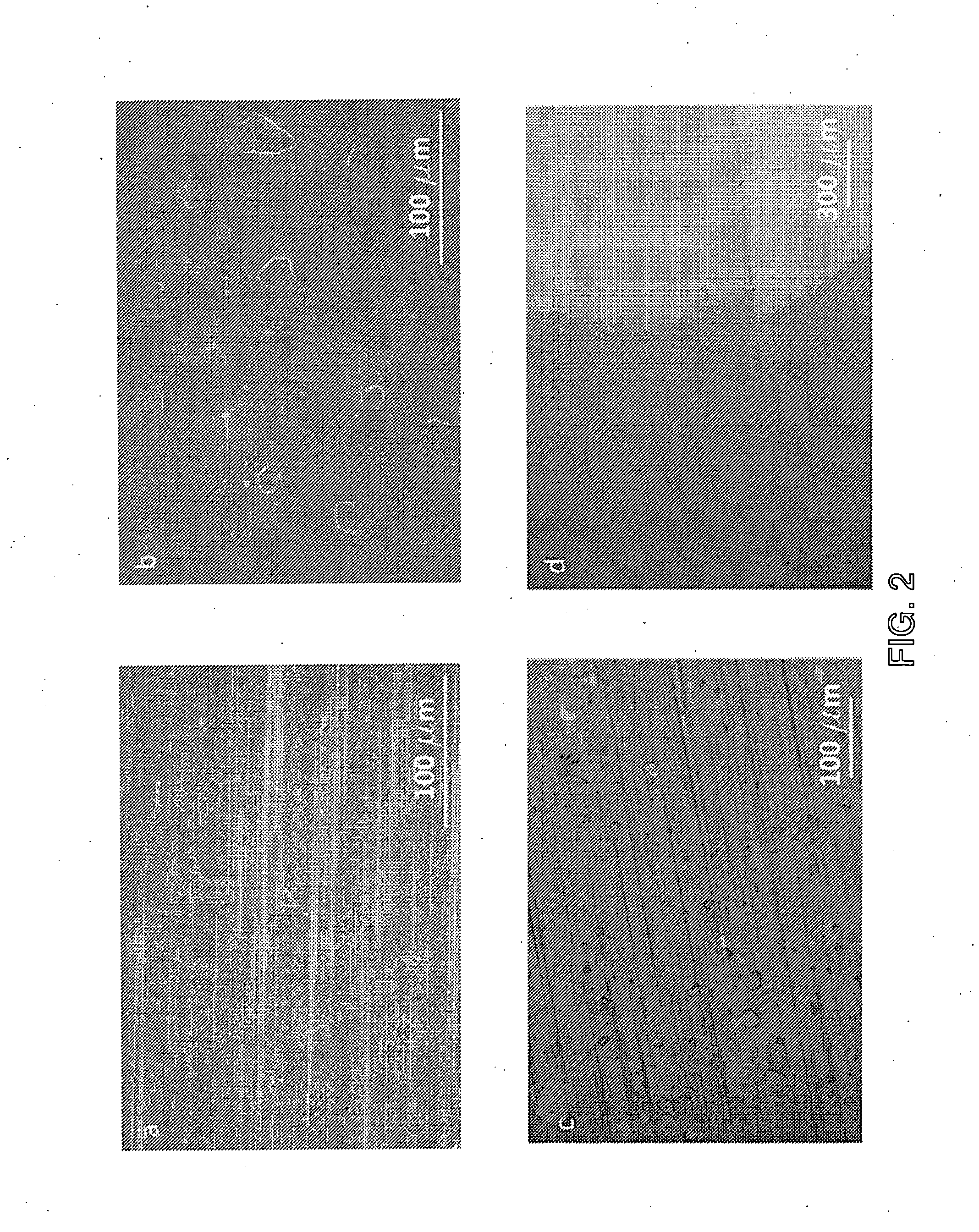 Rapid synthesis of graphene and formation of graphene structures