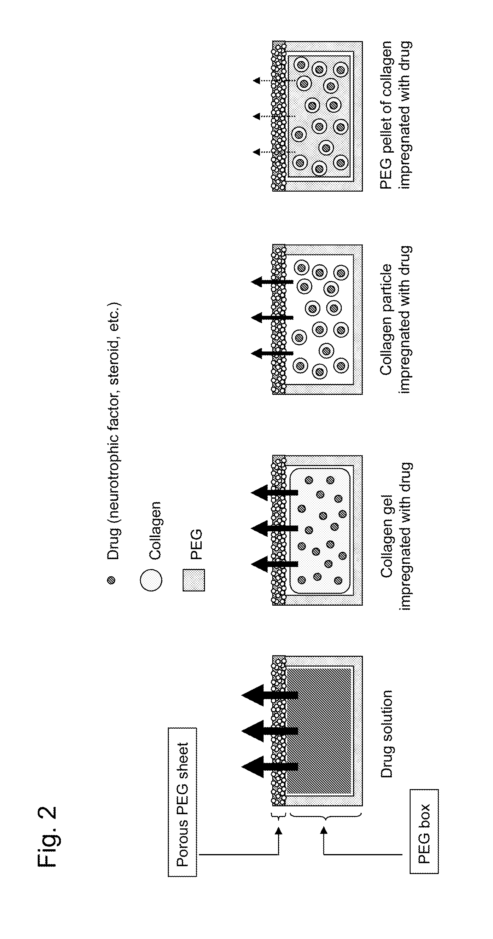 Sustained drug delivery system