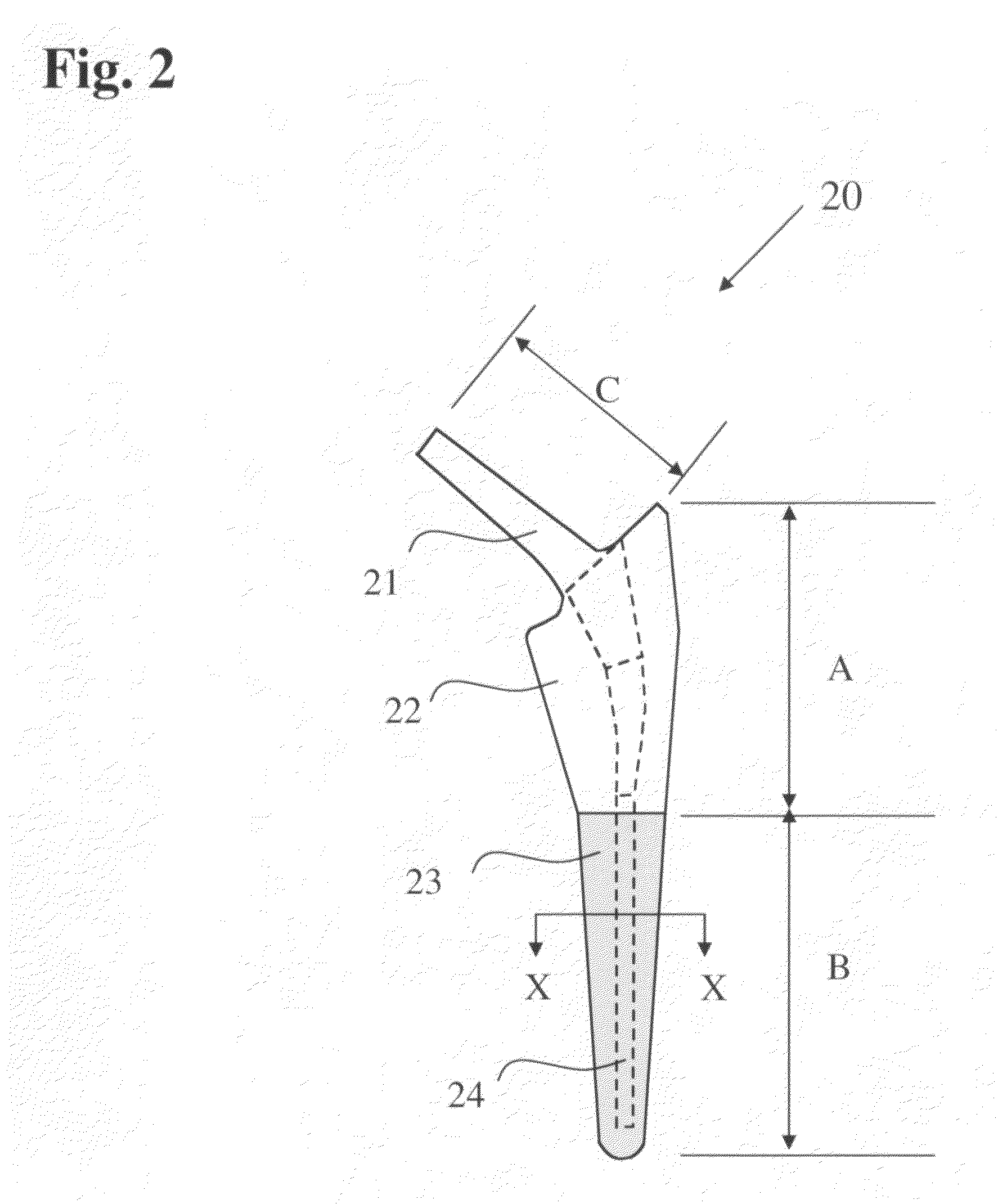 Bone-compliant femoral stem