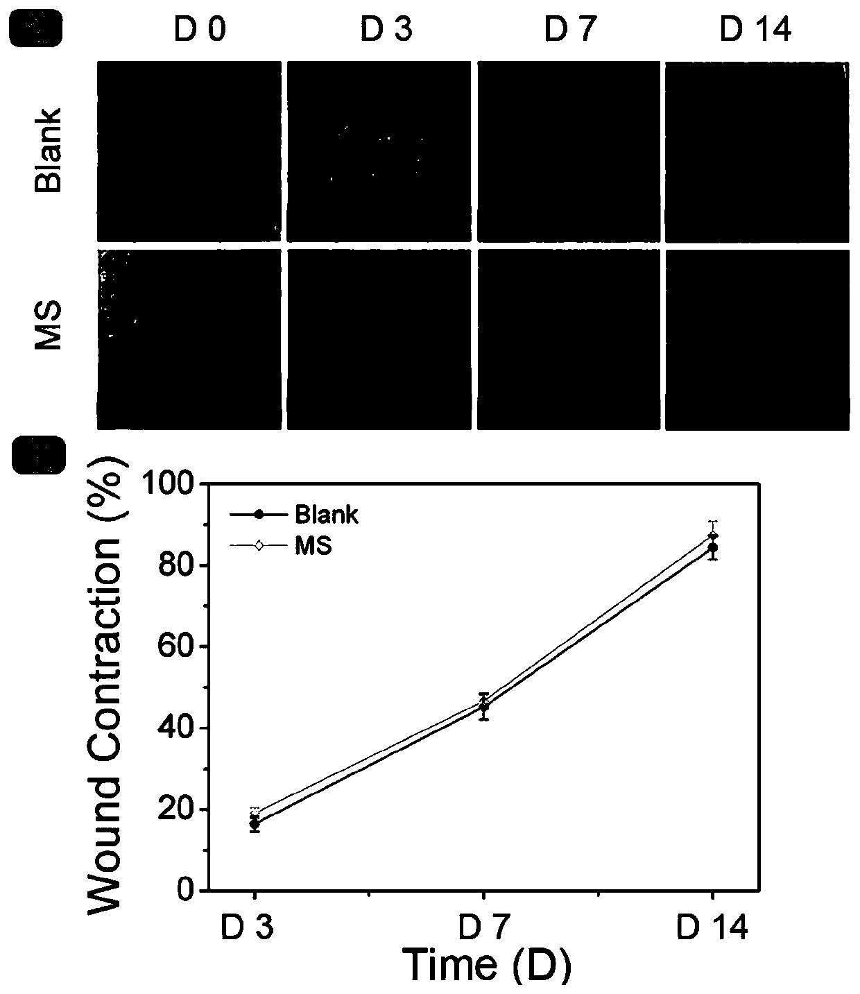 Preparation method of gelatin microspheres and application thereof