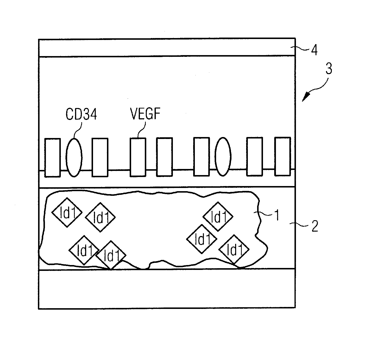 Diagnostic substance for use in a method for determining the aggressiveness of a prostate tumor and diagnostic method