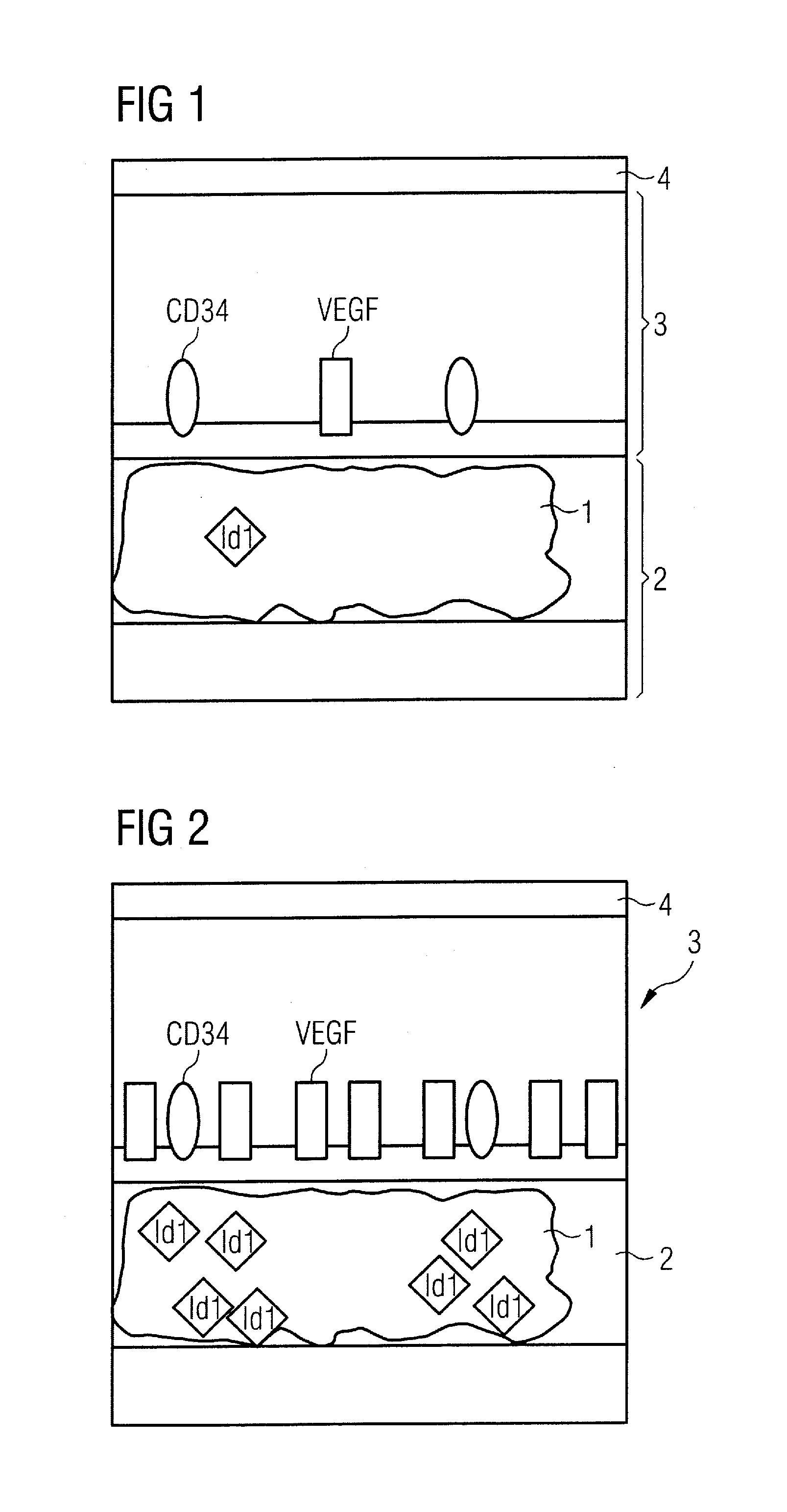 Diagnostic substance for use in a method for determining the aggressiveness of a prostate tumor and diagnostic method