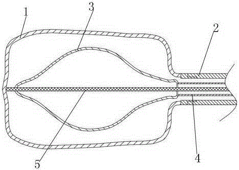 Adjustable high-pressure-expansion balloon bag