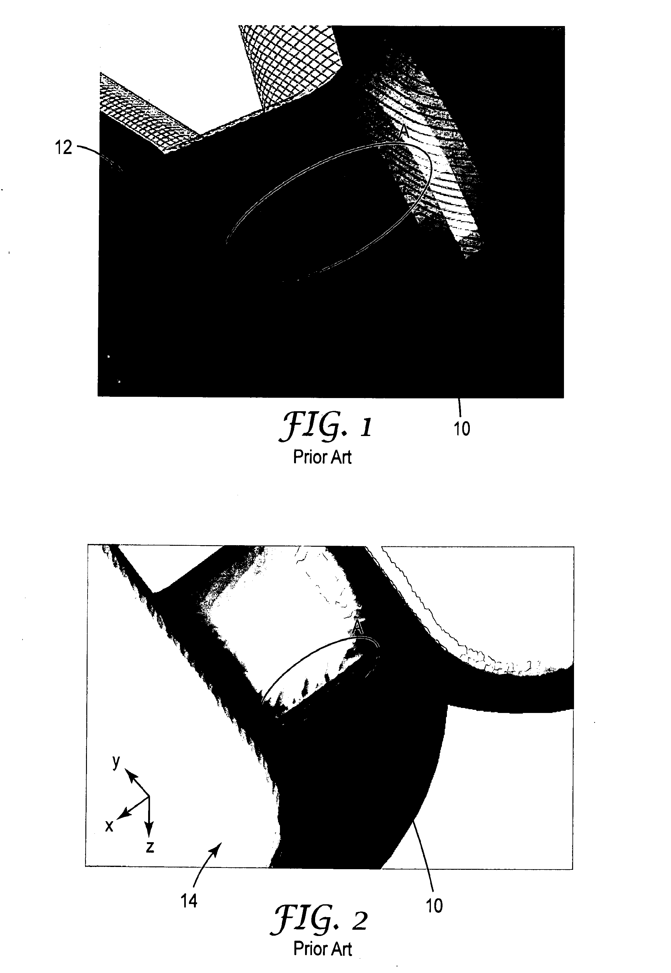 Method of producing a dental restoration