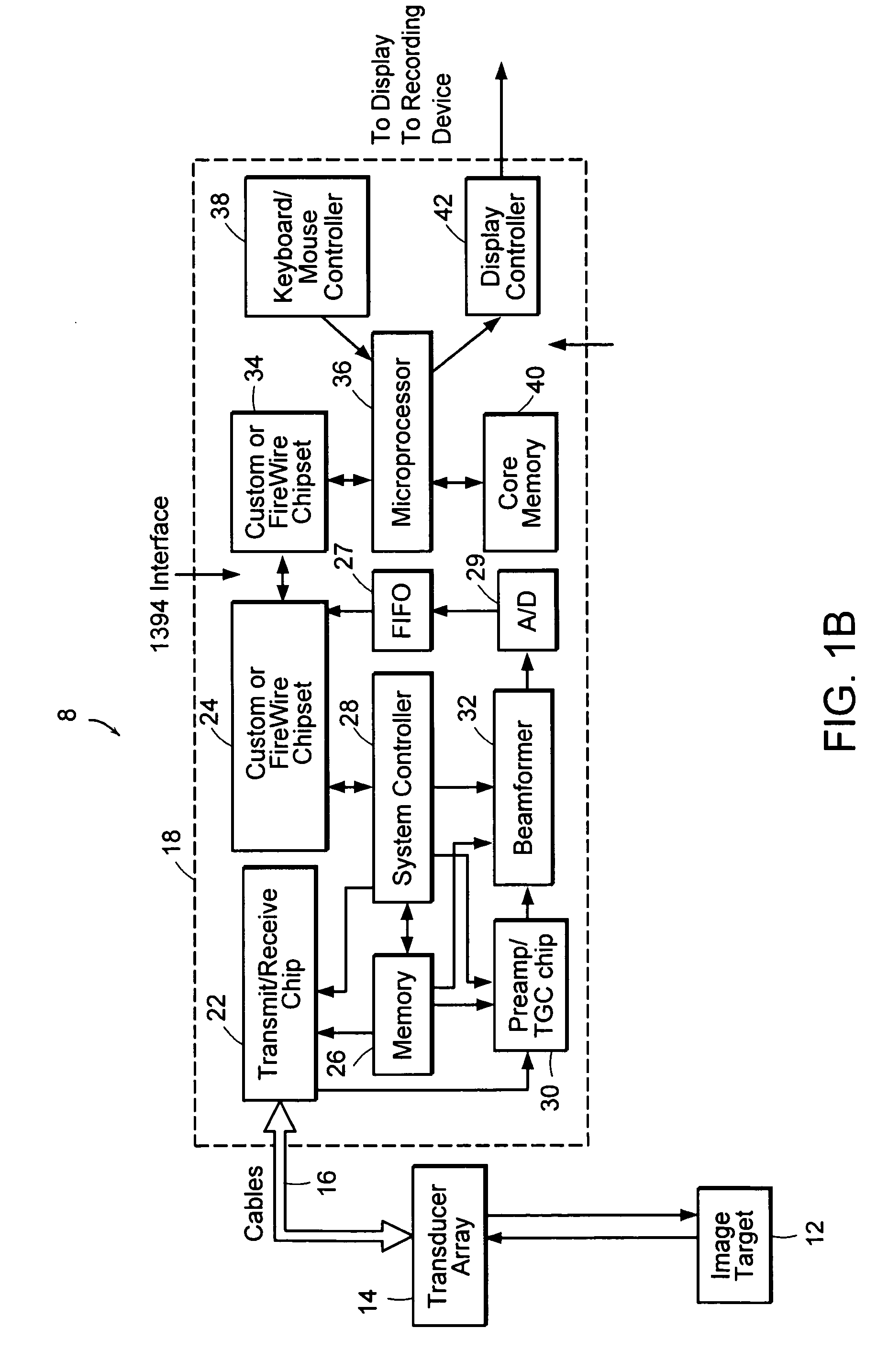 Wall motion analyzer