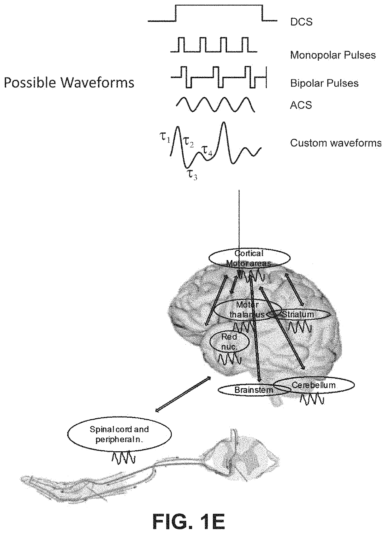 Systems Methods And Devices For Closed-Loop Stimulation To Enhance Stroke Recovery