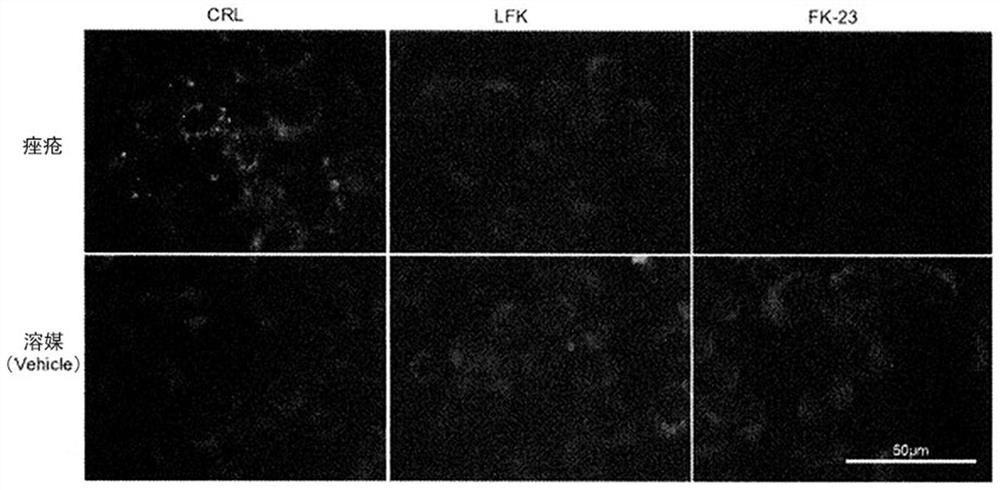 Agent for controlling sebaceous glands