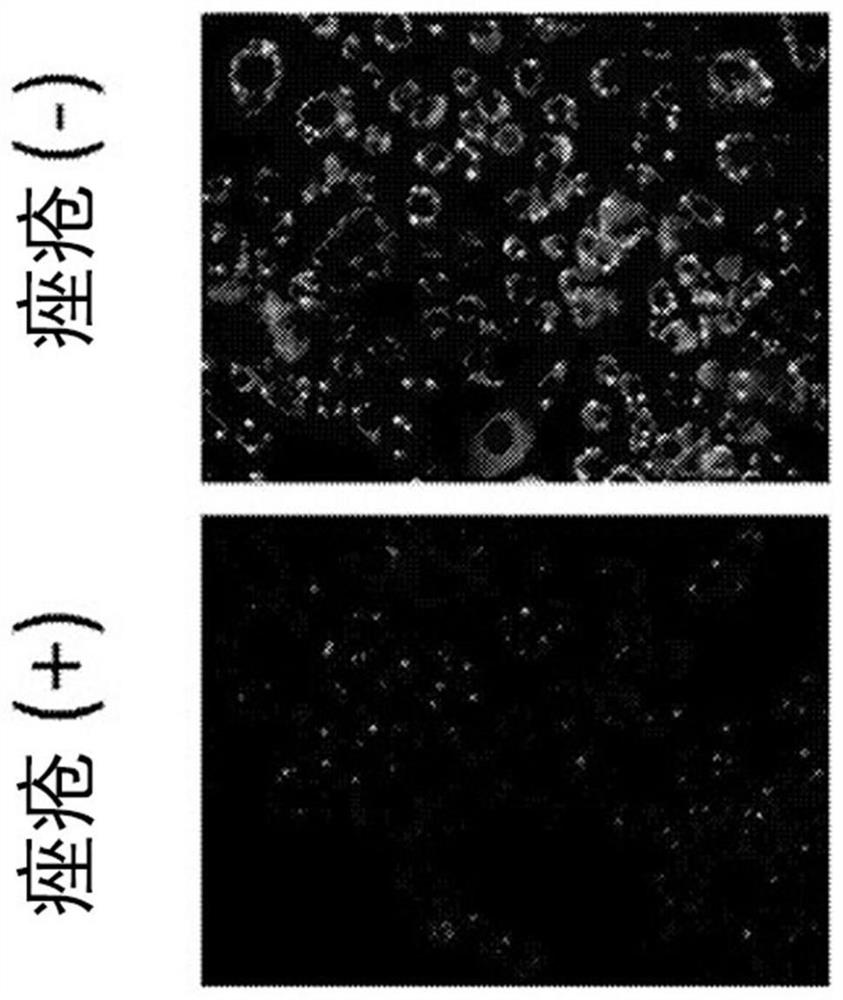 Agent for controlling sebaceous glands