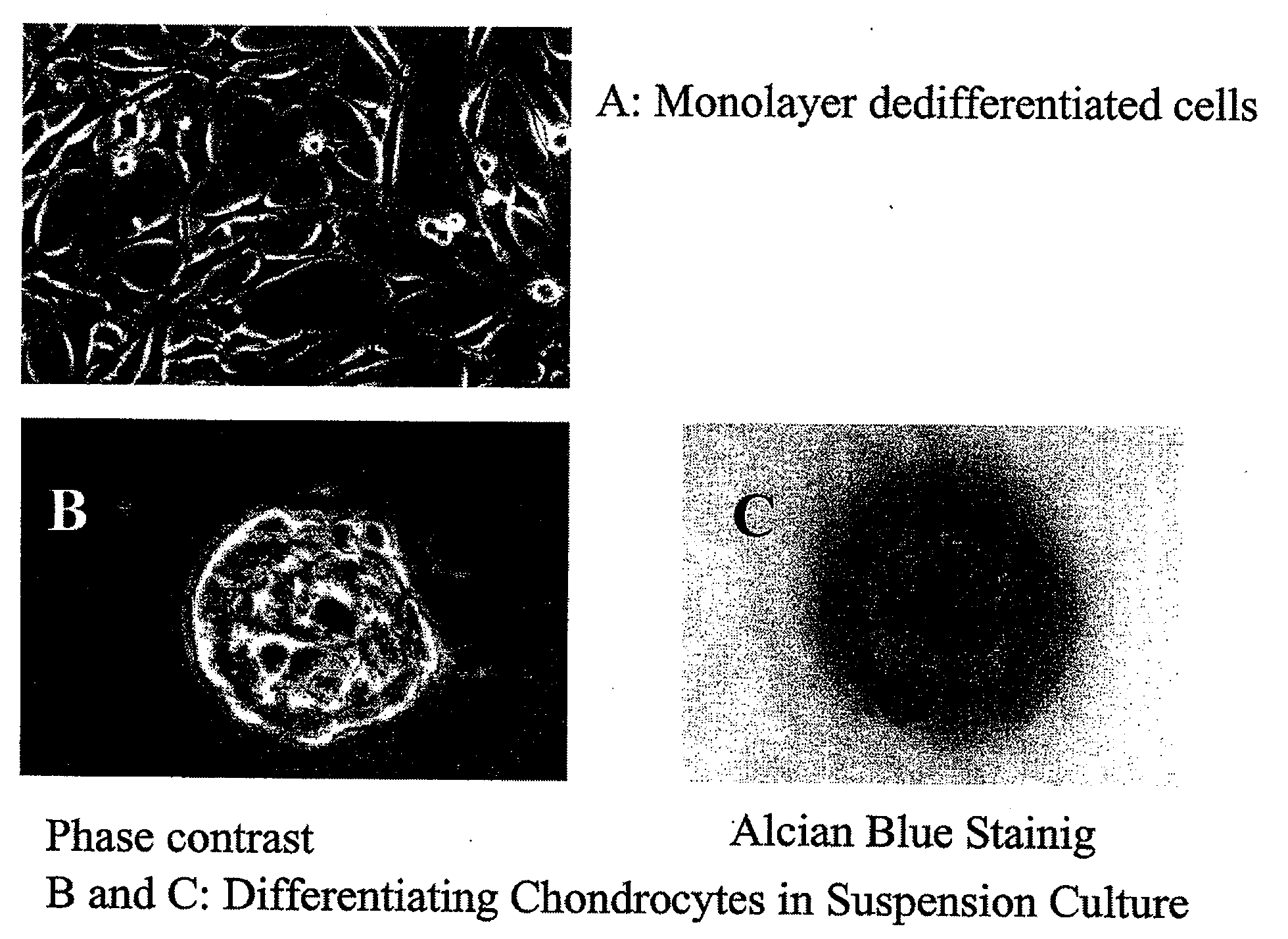 Chondrocyte therapeutic delivery system