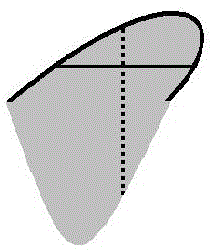 Medical image lossless compression method based on boundary extraction