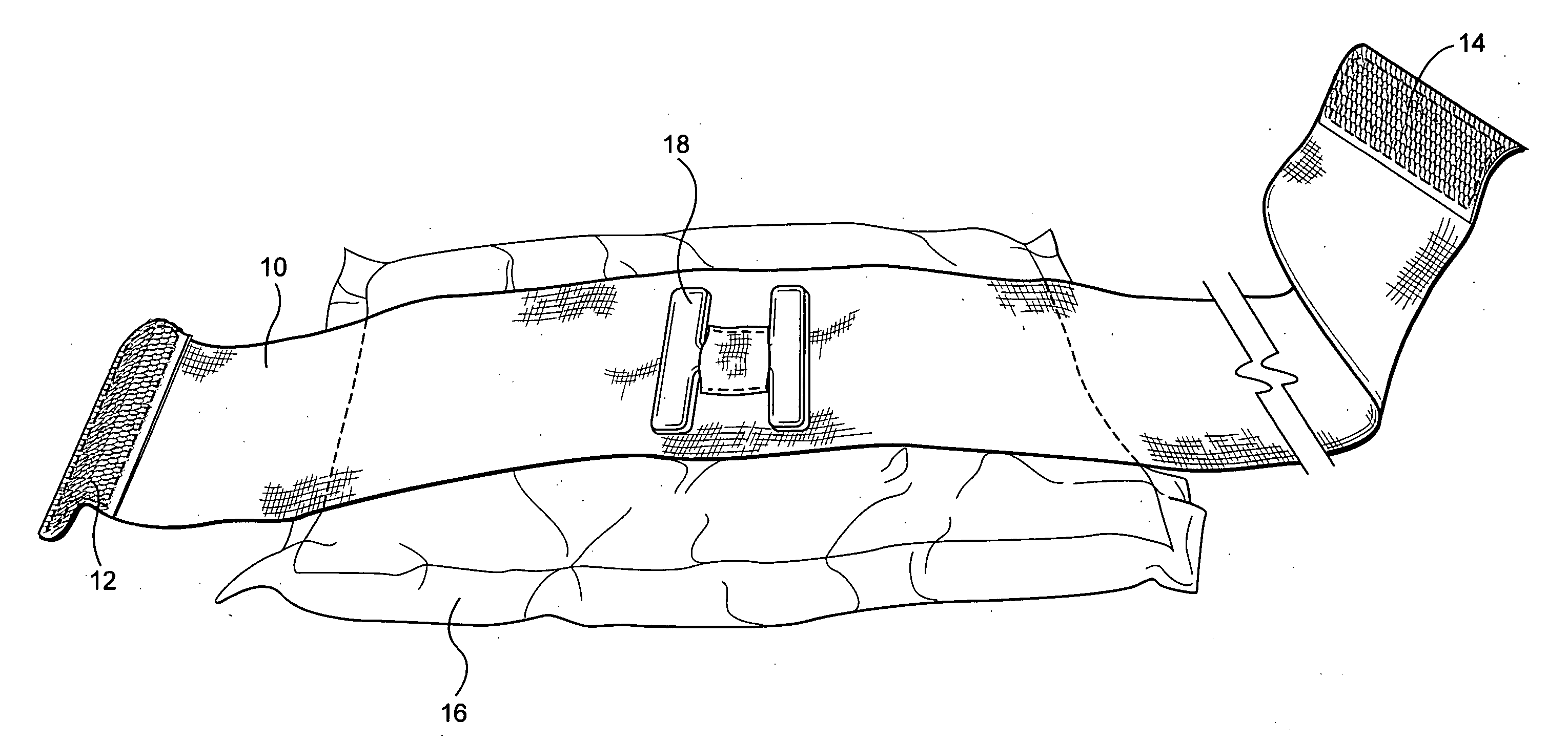 Compression bandage with H-anchor tightening means