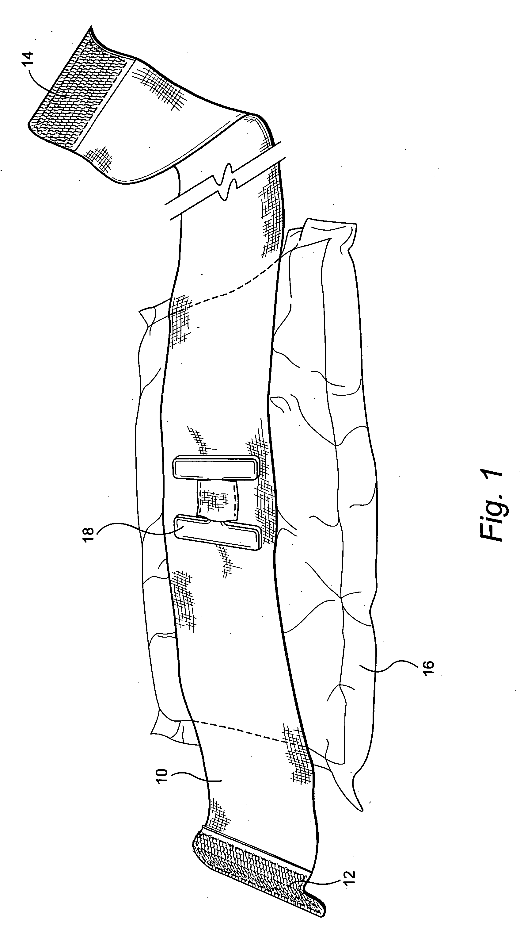 Compression bandage with H-anchor tightening means