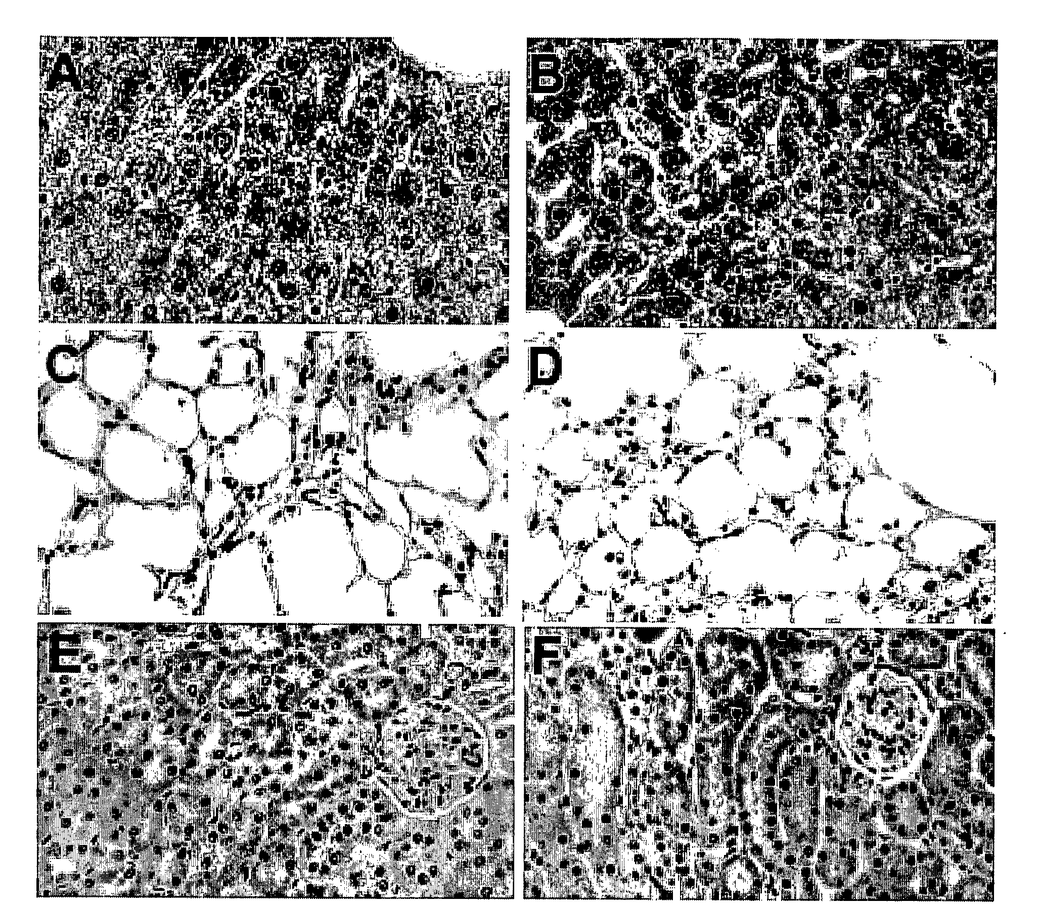 Pyridazine compounds and methods