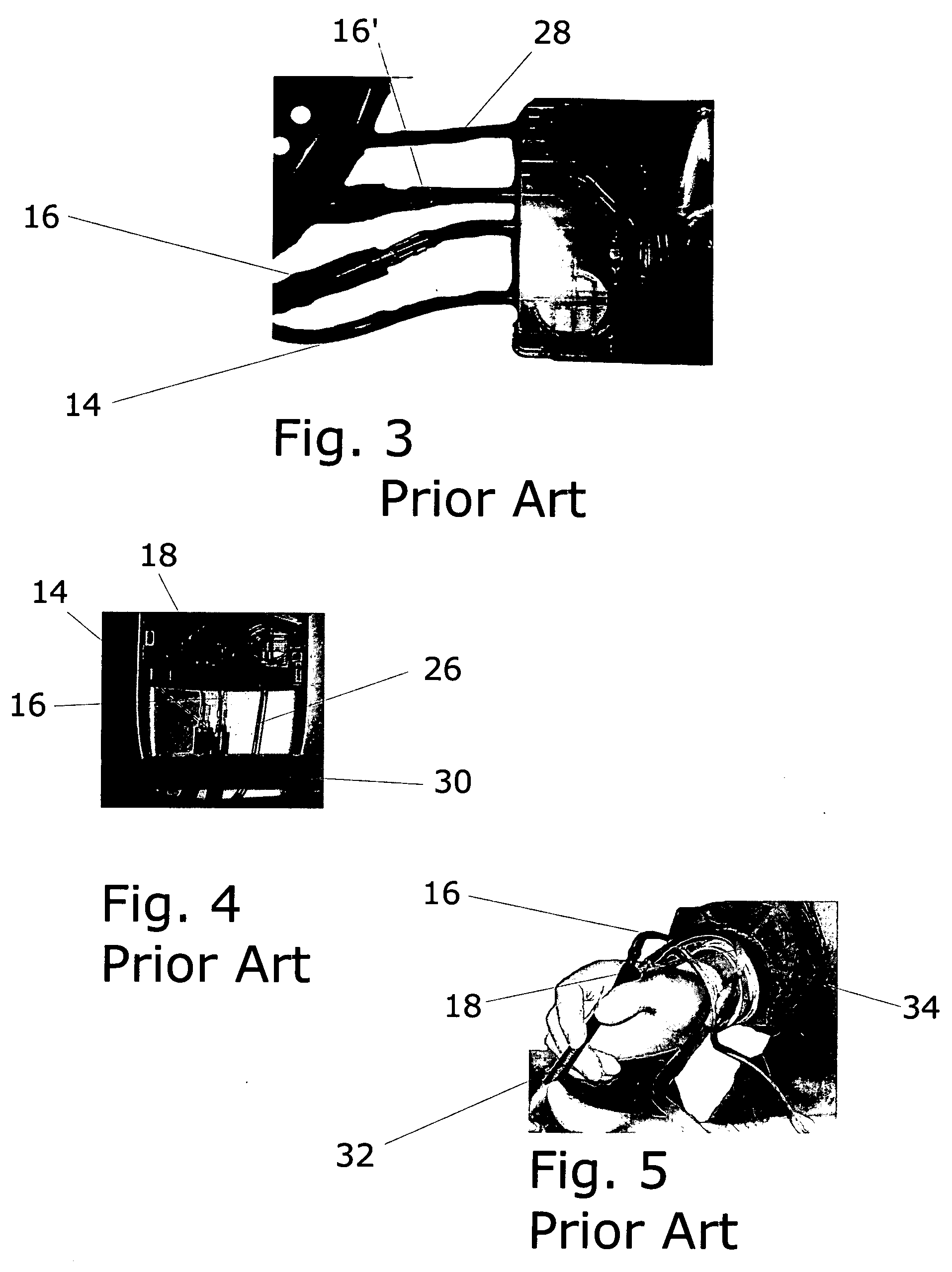 Coaxial tubing system for phacoemulsification handpieces