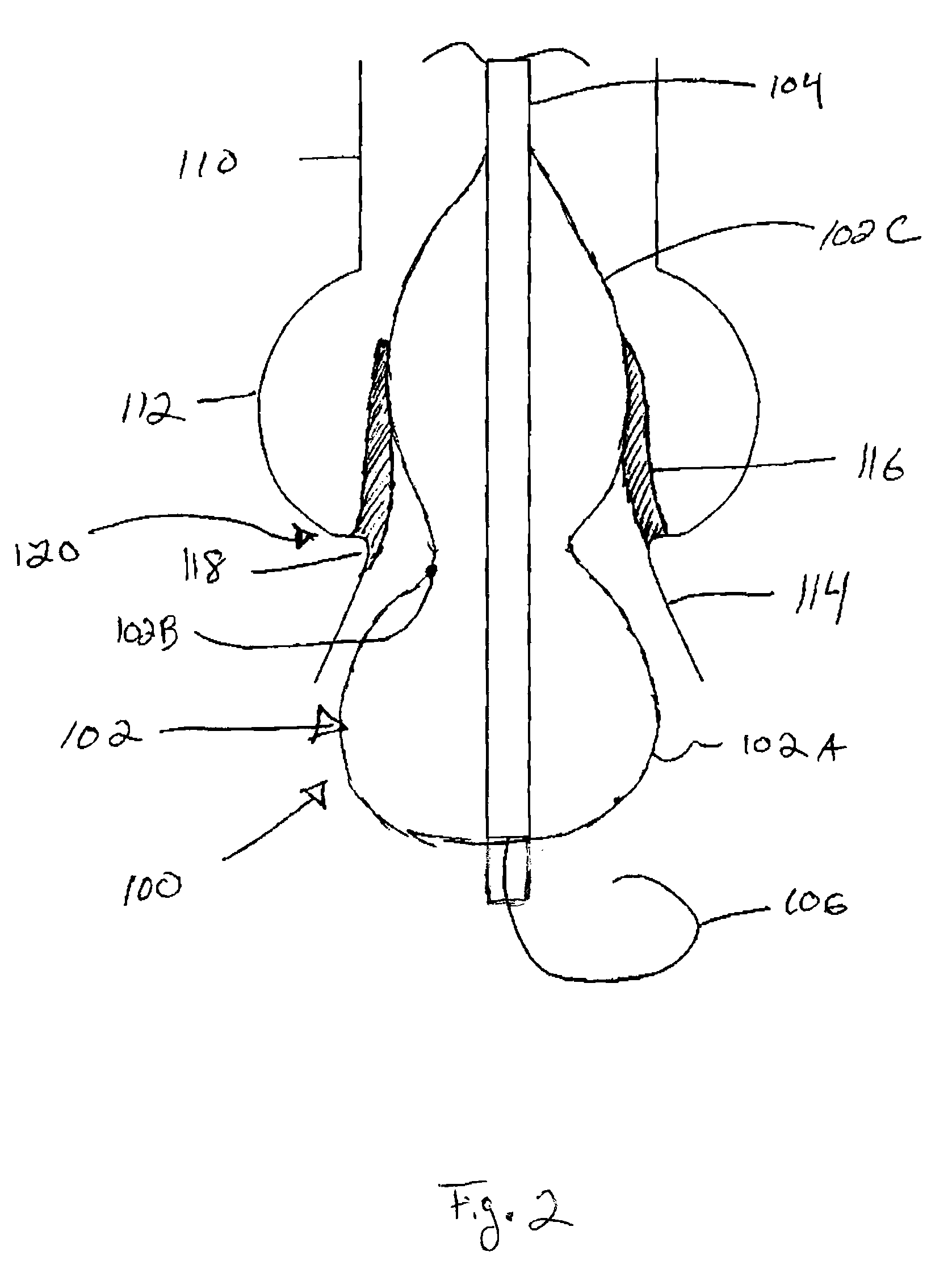 Valvuloplasty catheter and methods