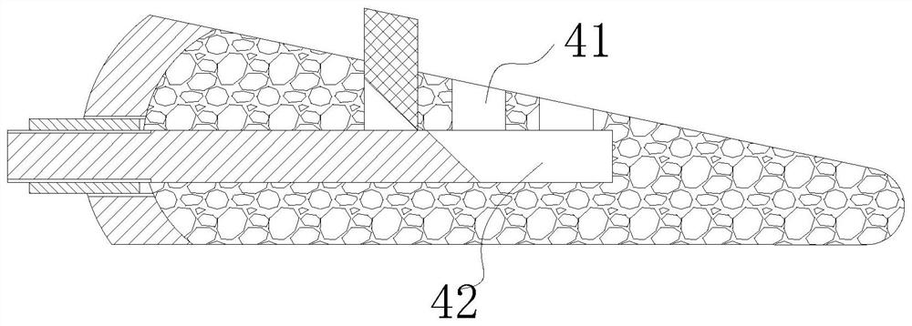 Absorbable gasket for high tibial osteotomy