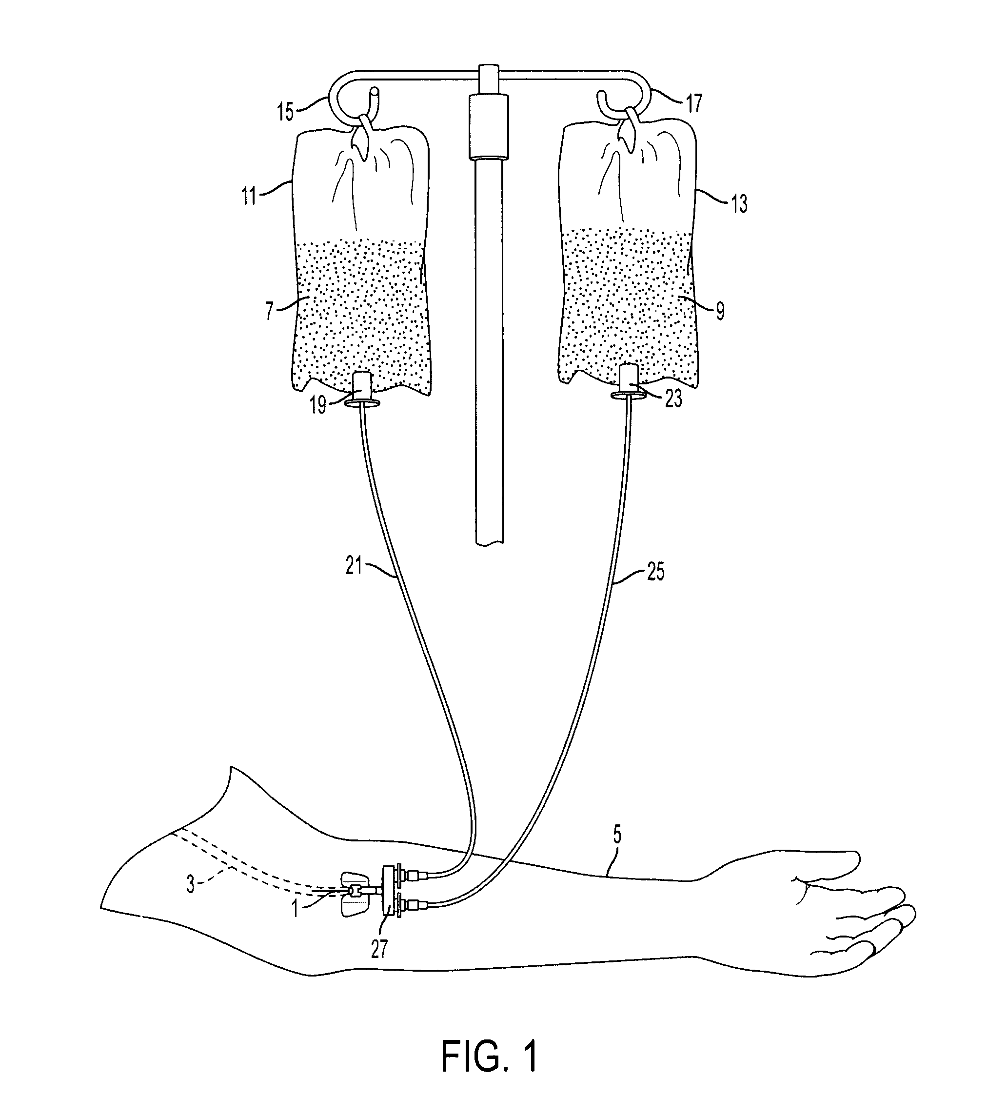 Intravenous infiltration detection