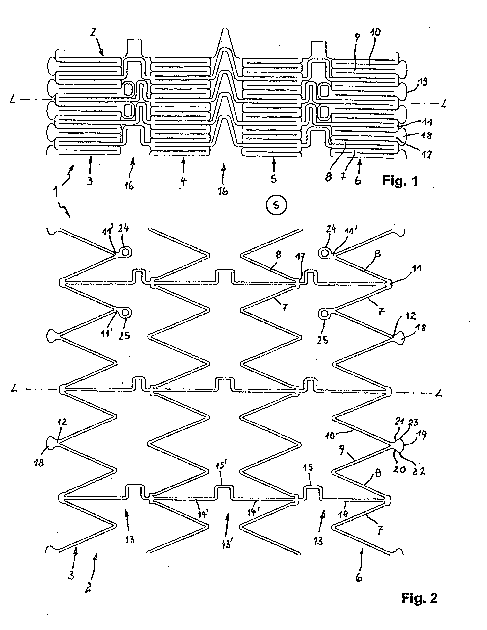 Removable Stent