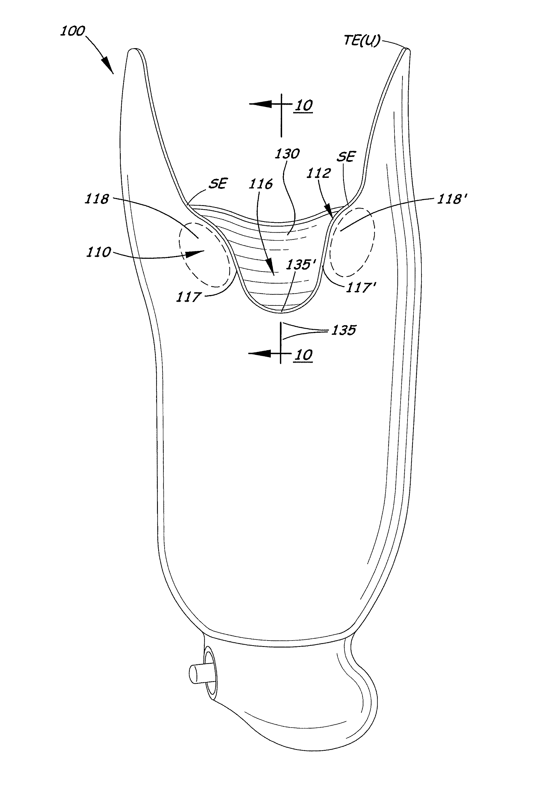 Transtibial socket for external prosthesis