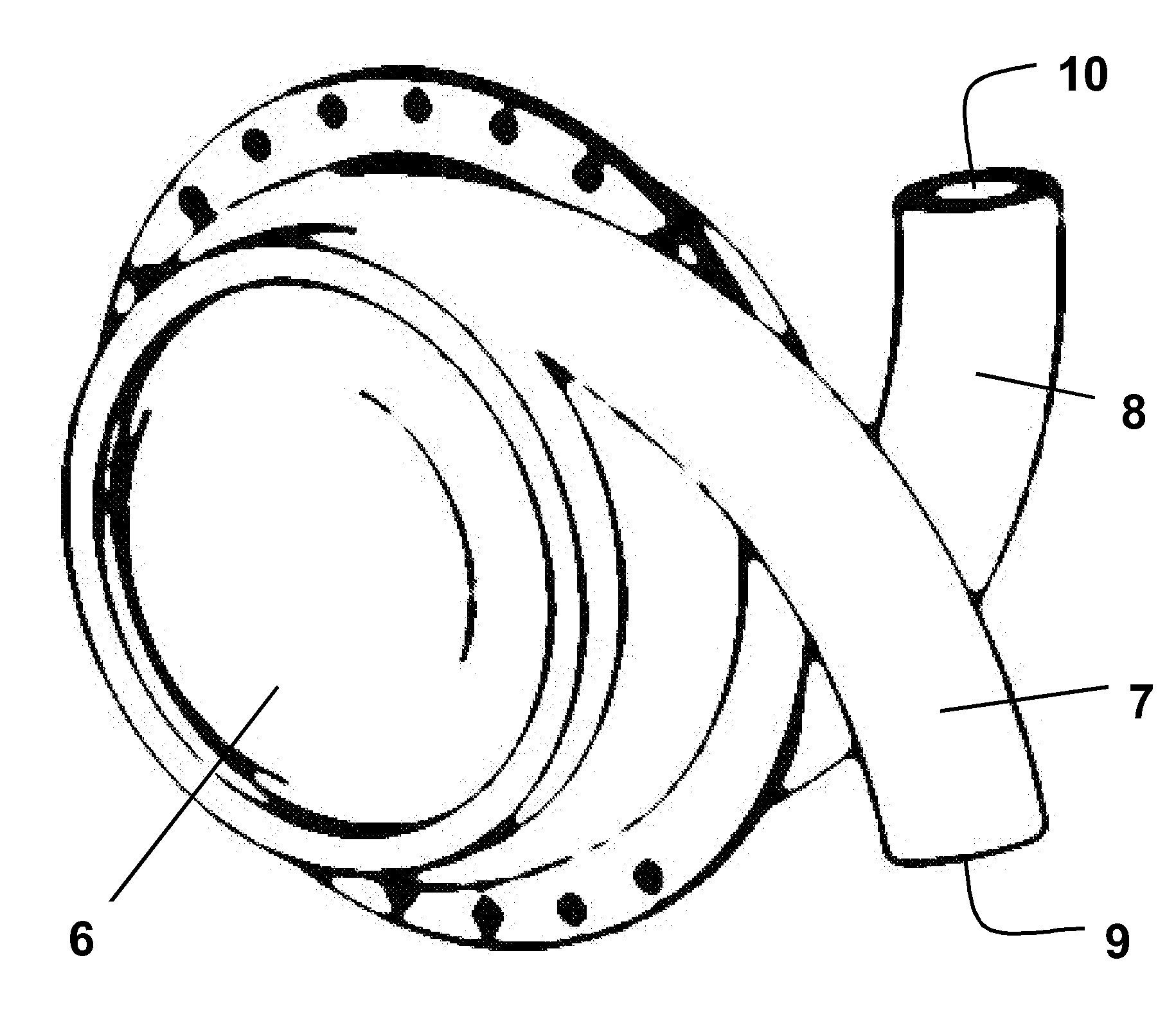 Heart assist device