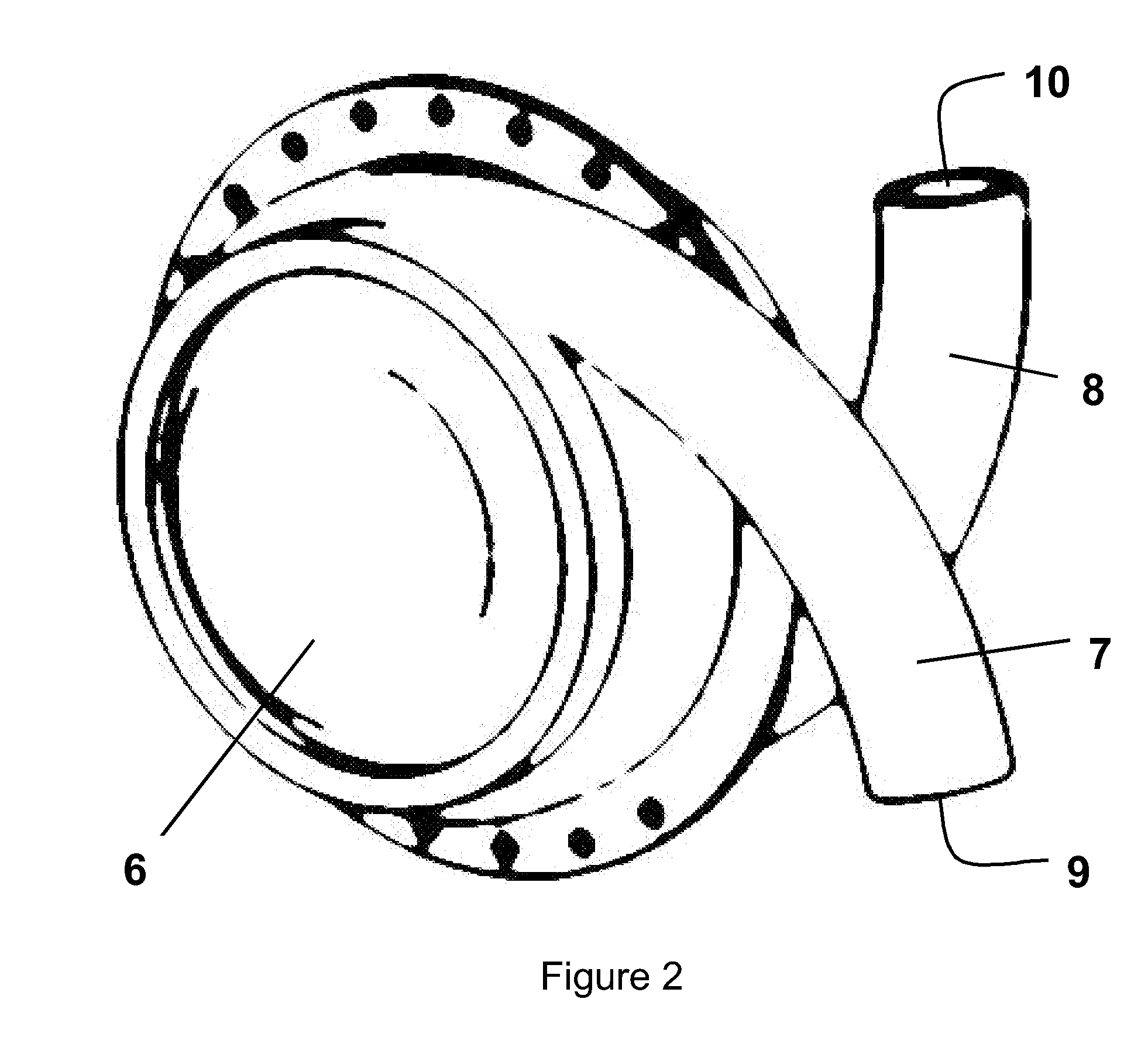 Heart assist device