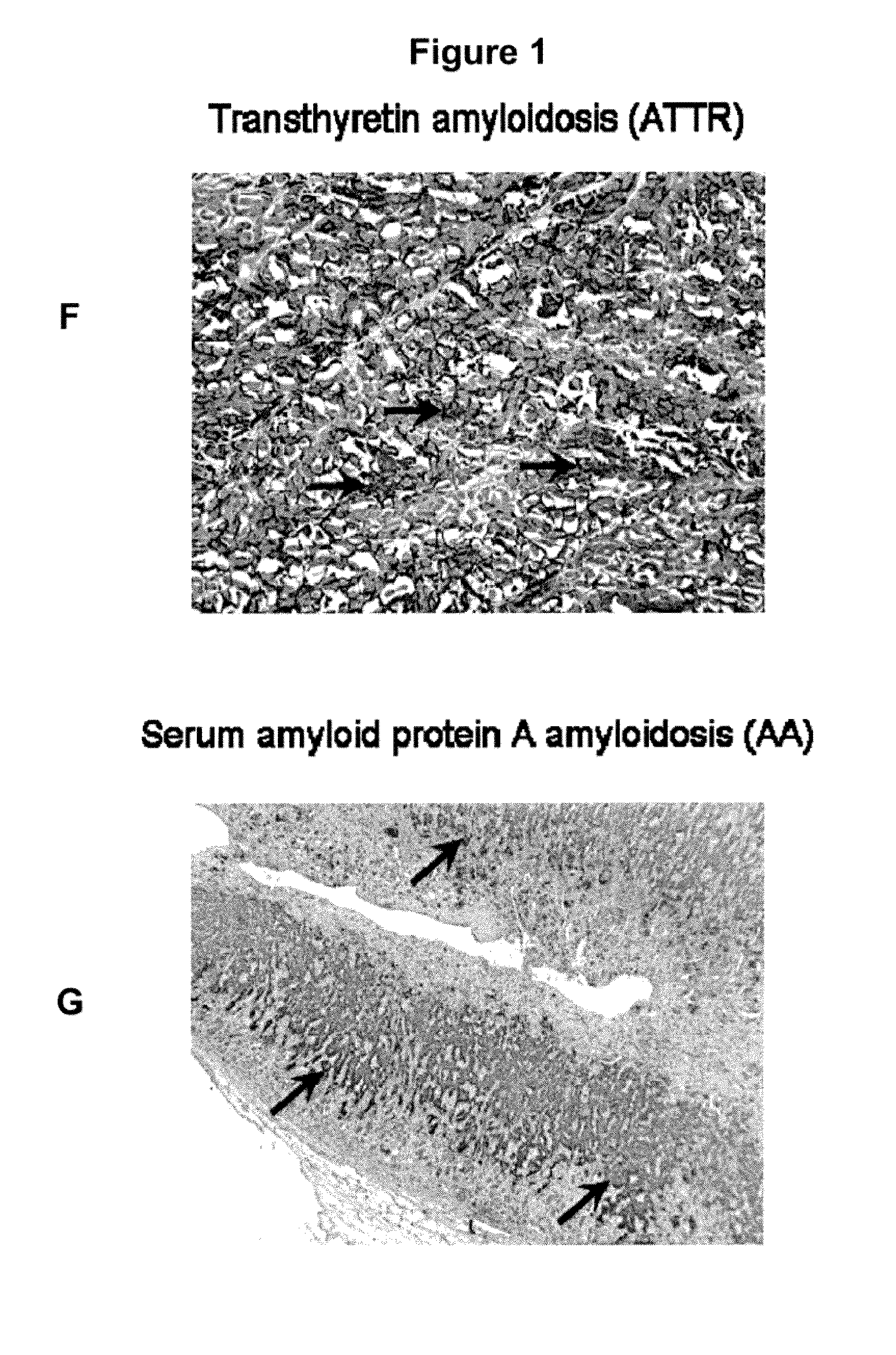 Peptides that Specifically Target Amyloid Deposits