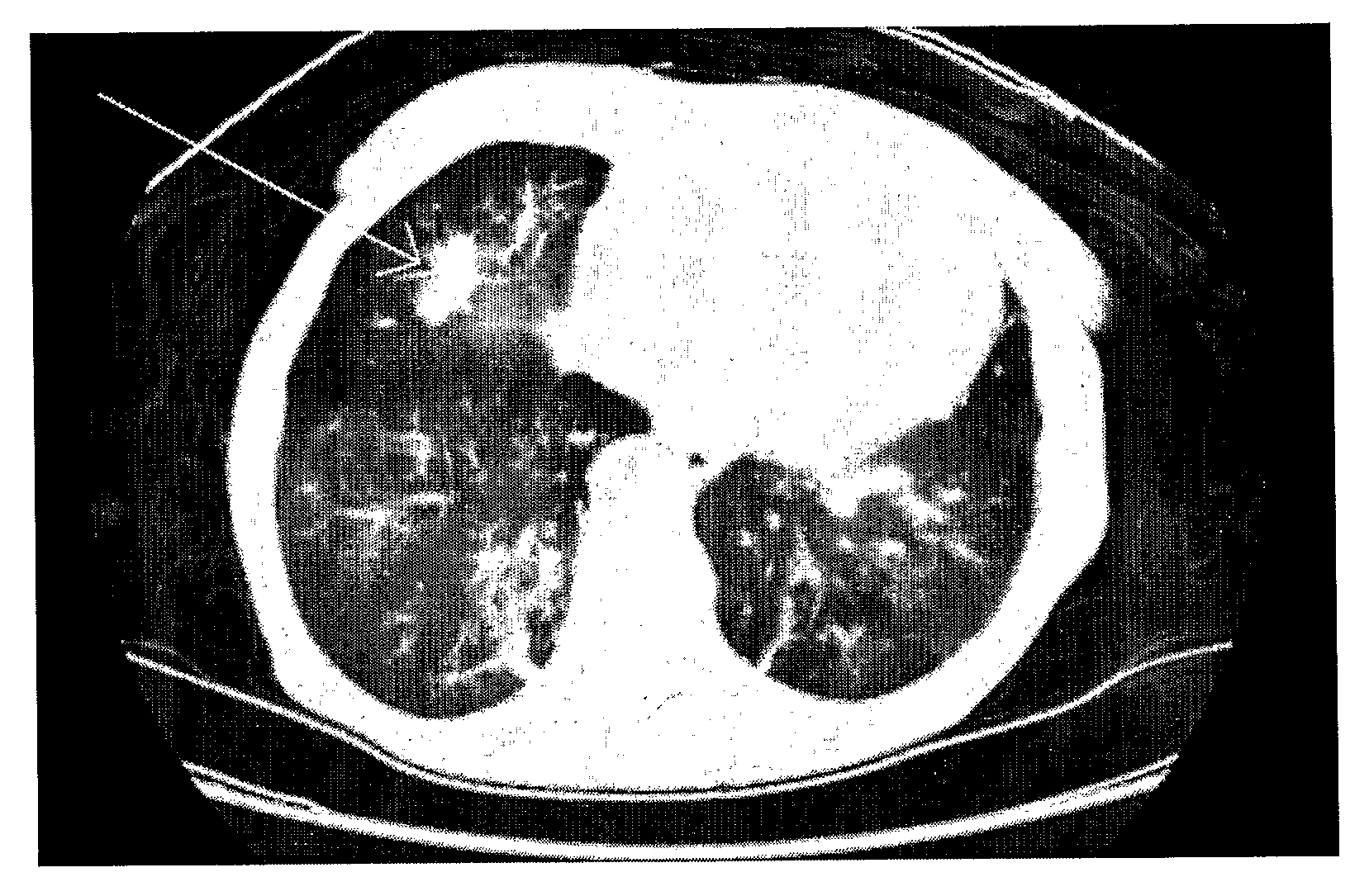 Analysing Breath Samples for Volatile Organic Compound