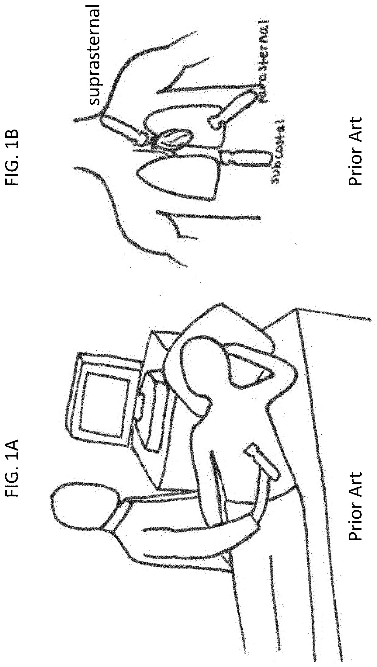 Ultrasound transducer holder