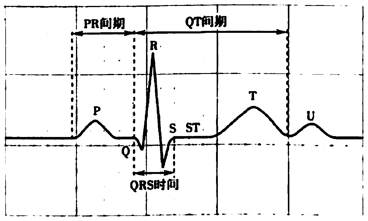 Image acquisition method of magnetic resonance scanner and device thereof, equipment and medium