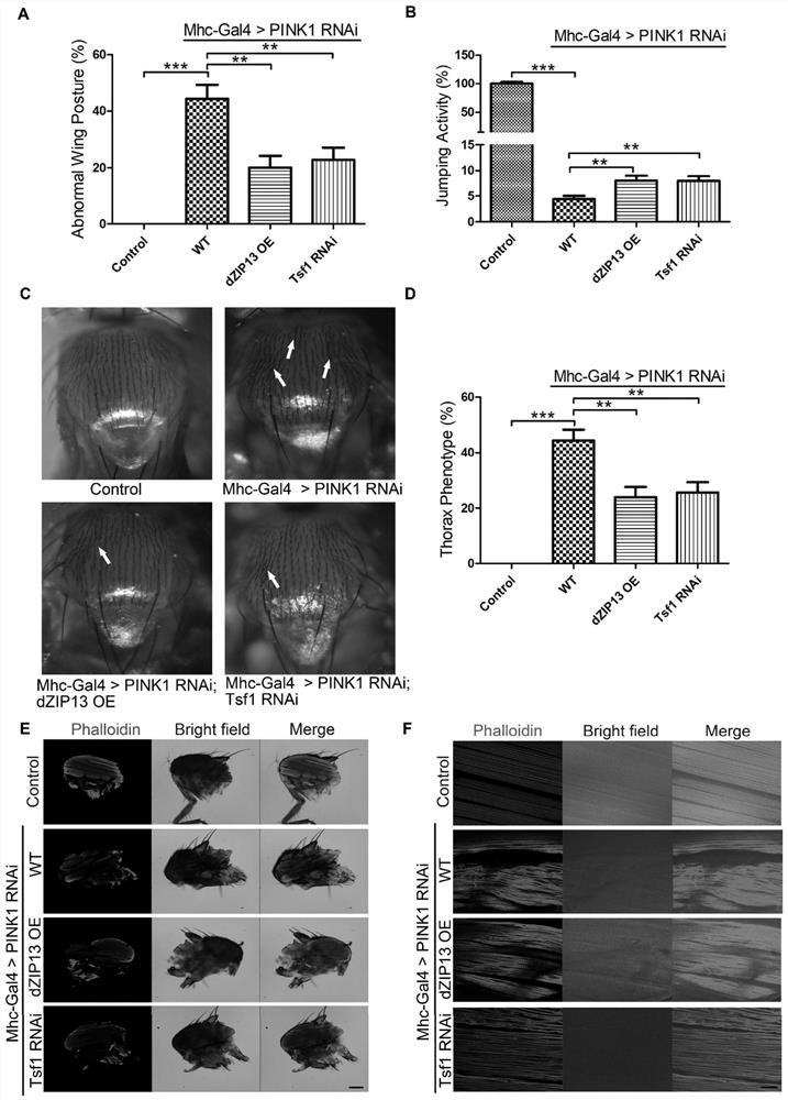 Application of iron transporter in treatment of Parkinson's disease