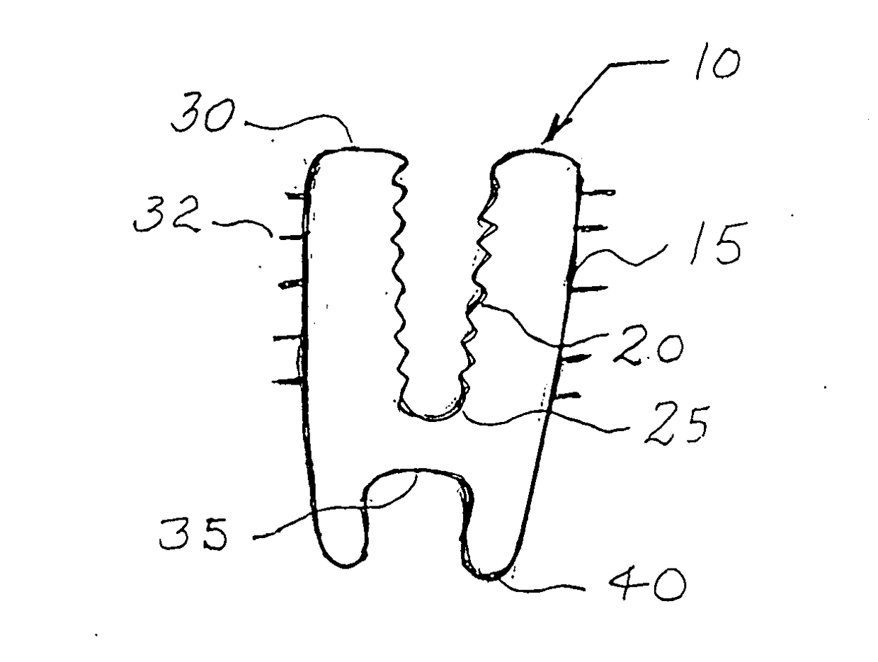 Anchoring system for prosthetics