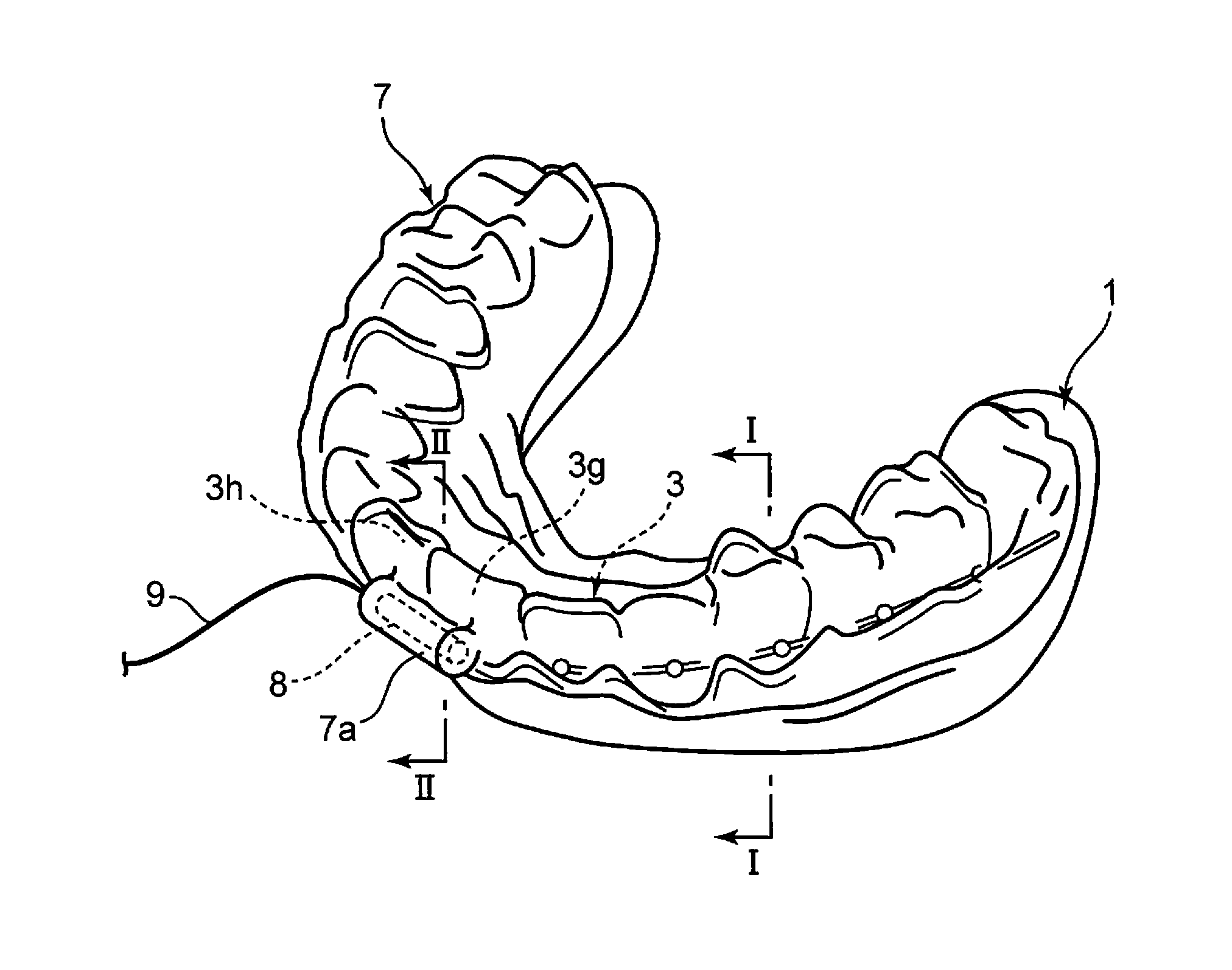 Dental vibration application method and dental vibration application device