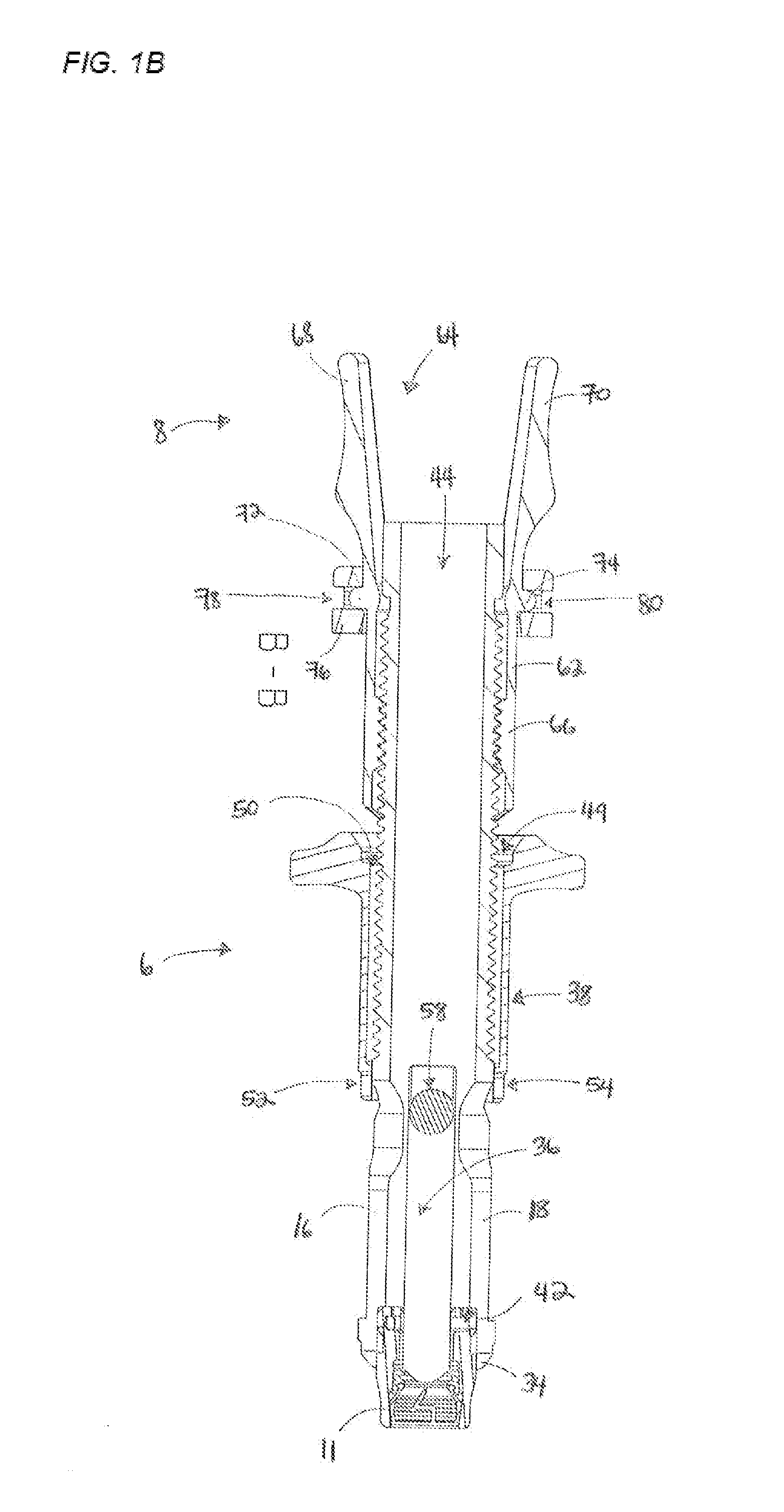 Orthopedic Fixation Devices and Instruments for Installation Thereof