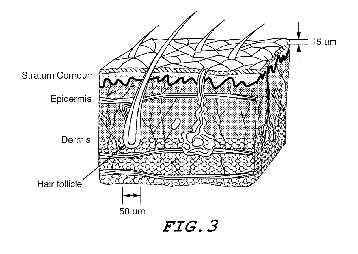 Modified transdermal delivery device or patch and method of delivering insulin from said modified transdermal delivery device