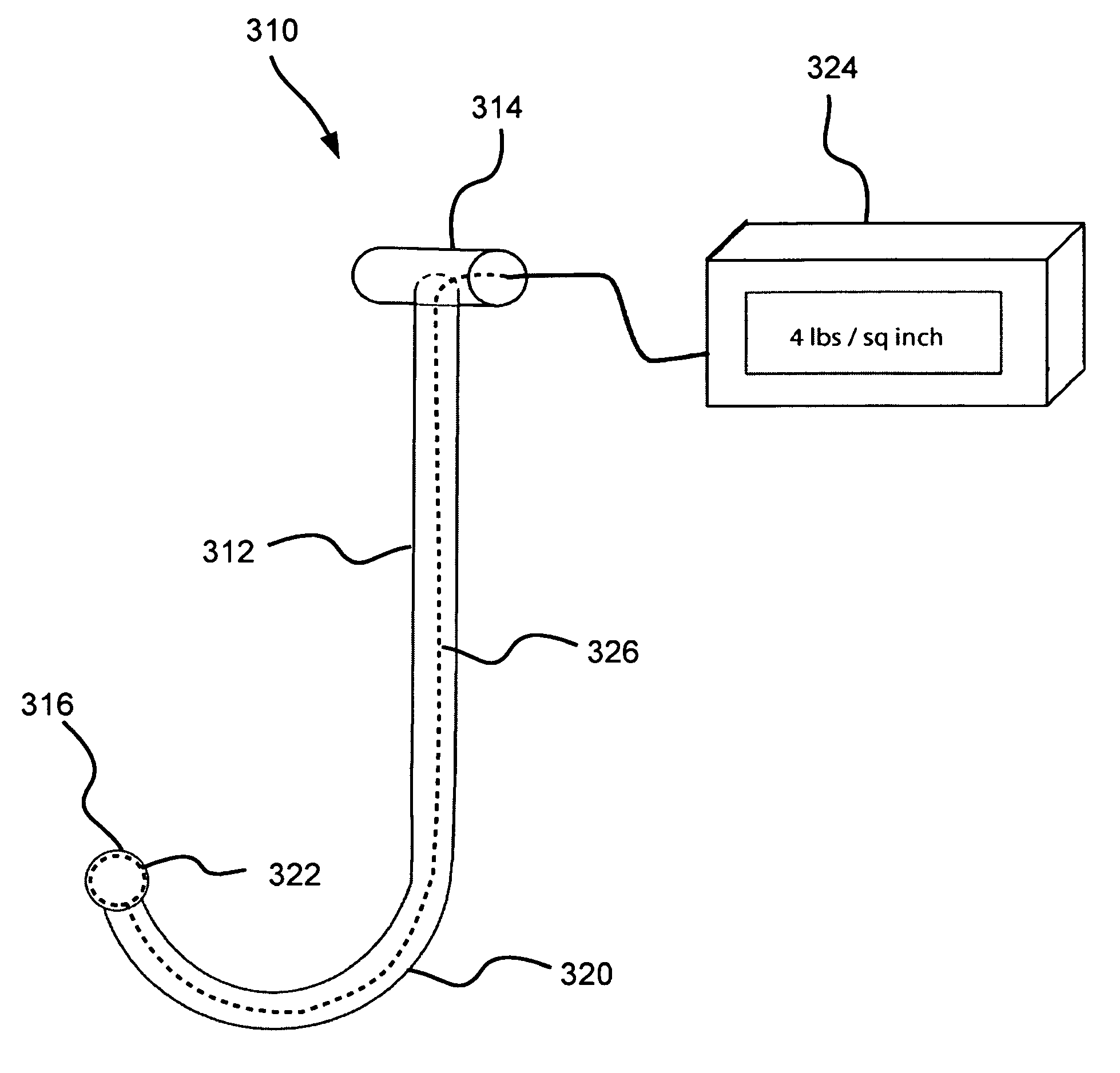 Method and apparatus for treating pelvic pain