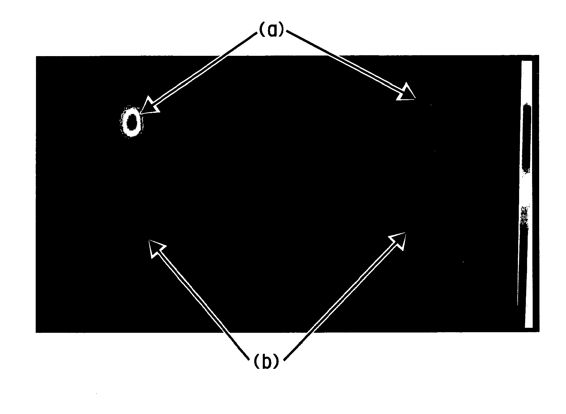 Method of imaging localized infections