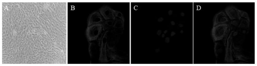 Application of miR-26a in preparation of medicine for treating endometritis