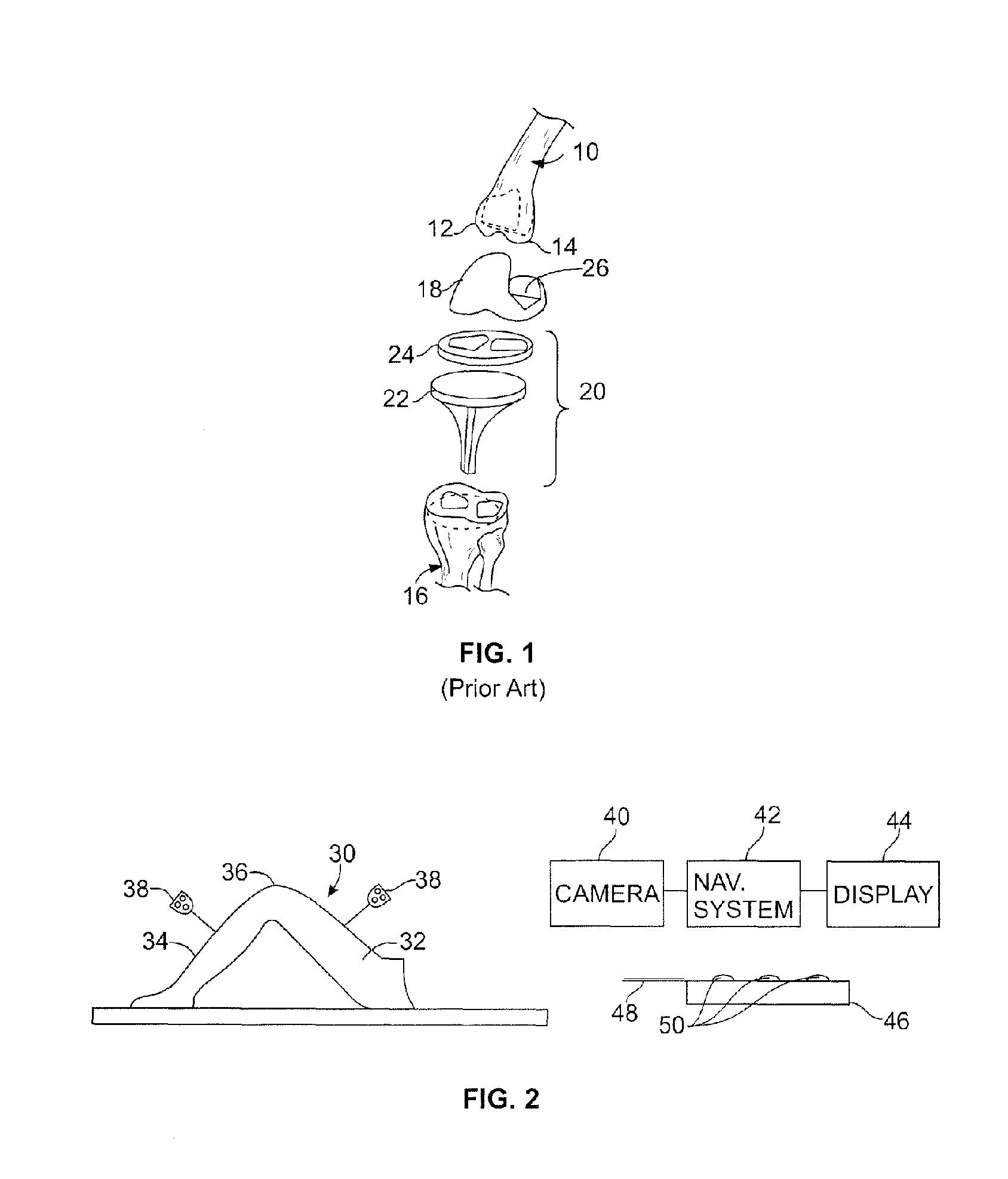 Method of and System for Planning a Surgery