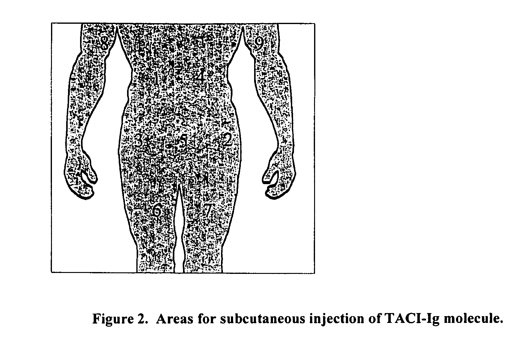 Methods for treating B-cell malignancies using a TACI-Ig fusion molecule