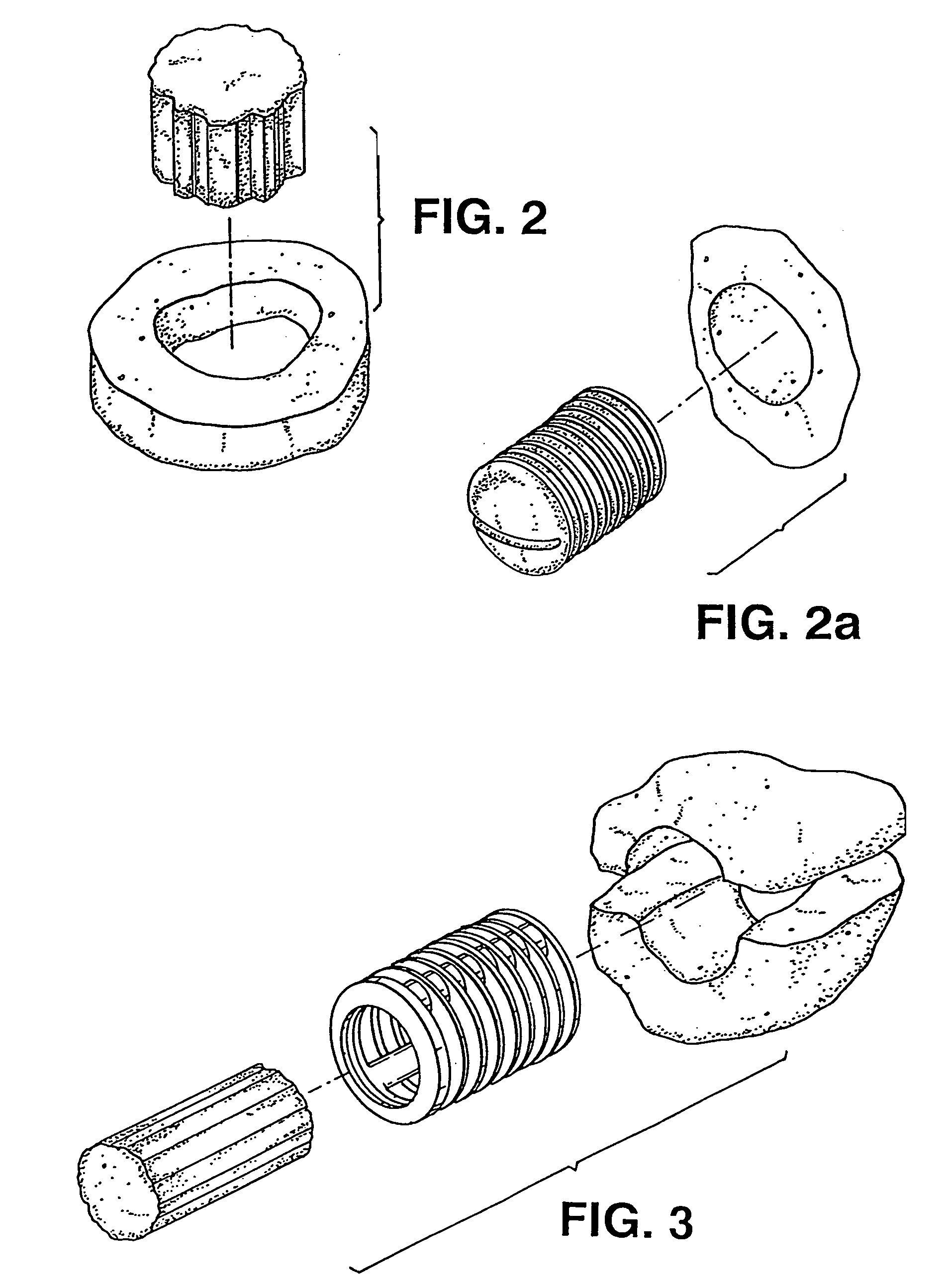 Osteoimplant and method of making same