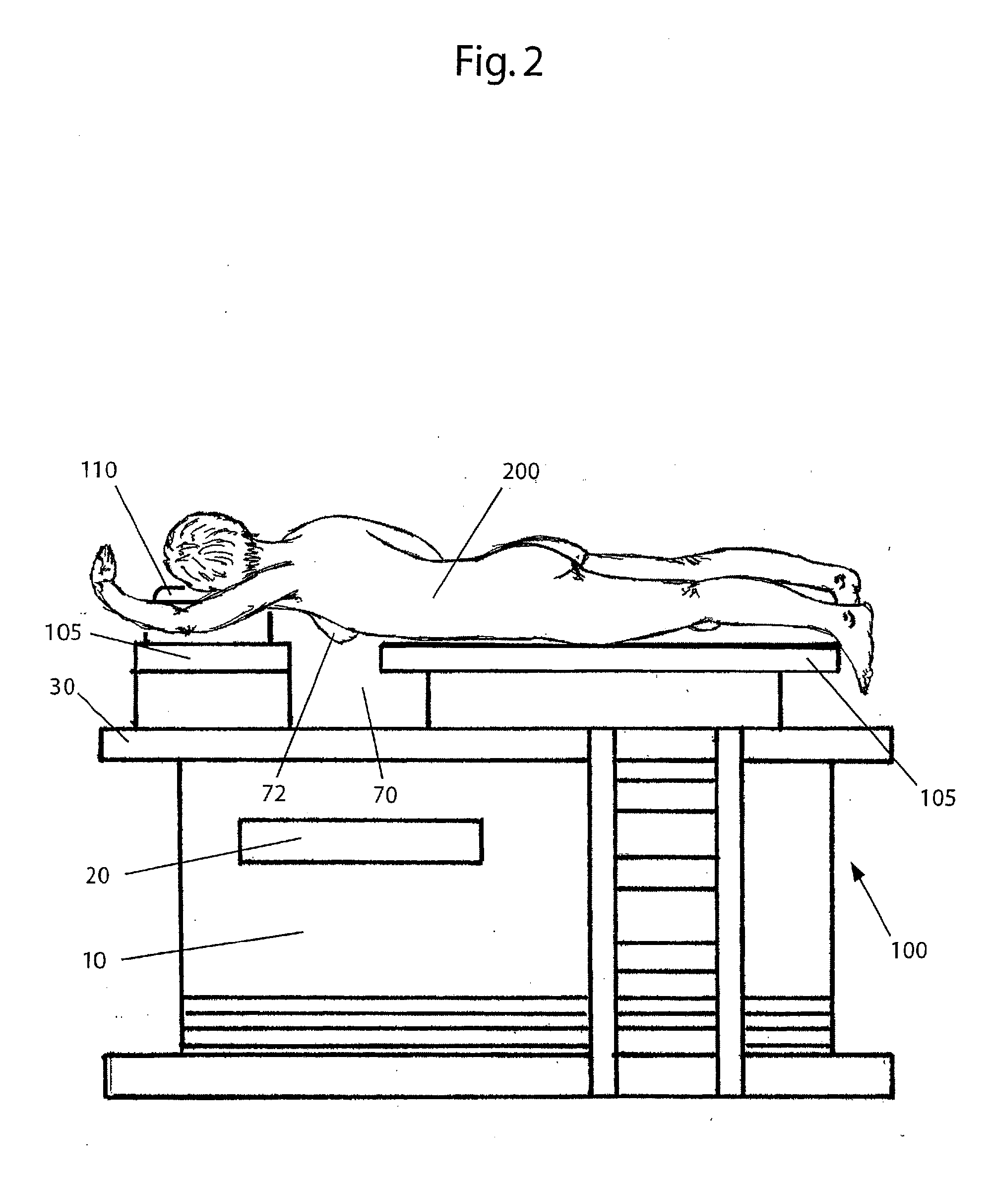 Radiation treatment table and method for prone breast radiation treatment